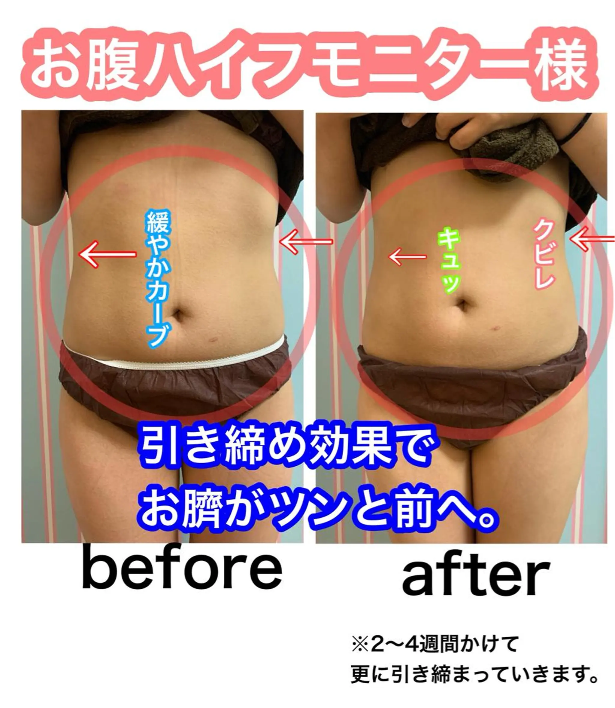 エステ 痩身/脱毛/ネイル HARUKAのエステ・リラクイメージ