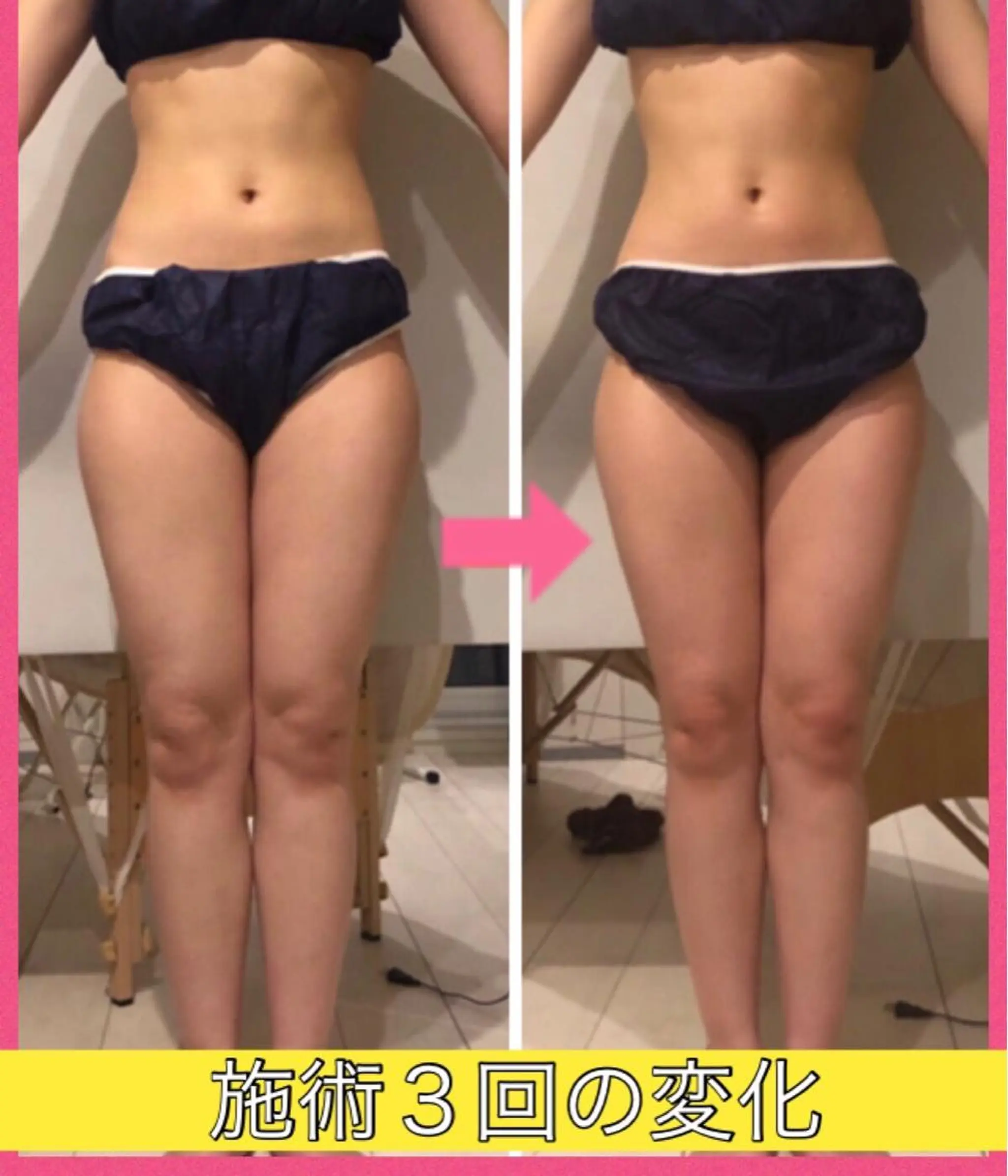 ロング カラー パーマ ヘアアレンジ メンズ キッズ ネイル マツエク・マツパ ‍痩身＆ボディ 結果出し🌟丹野のエステ・リラクイメージ