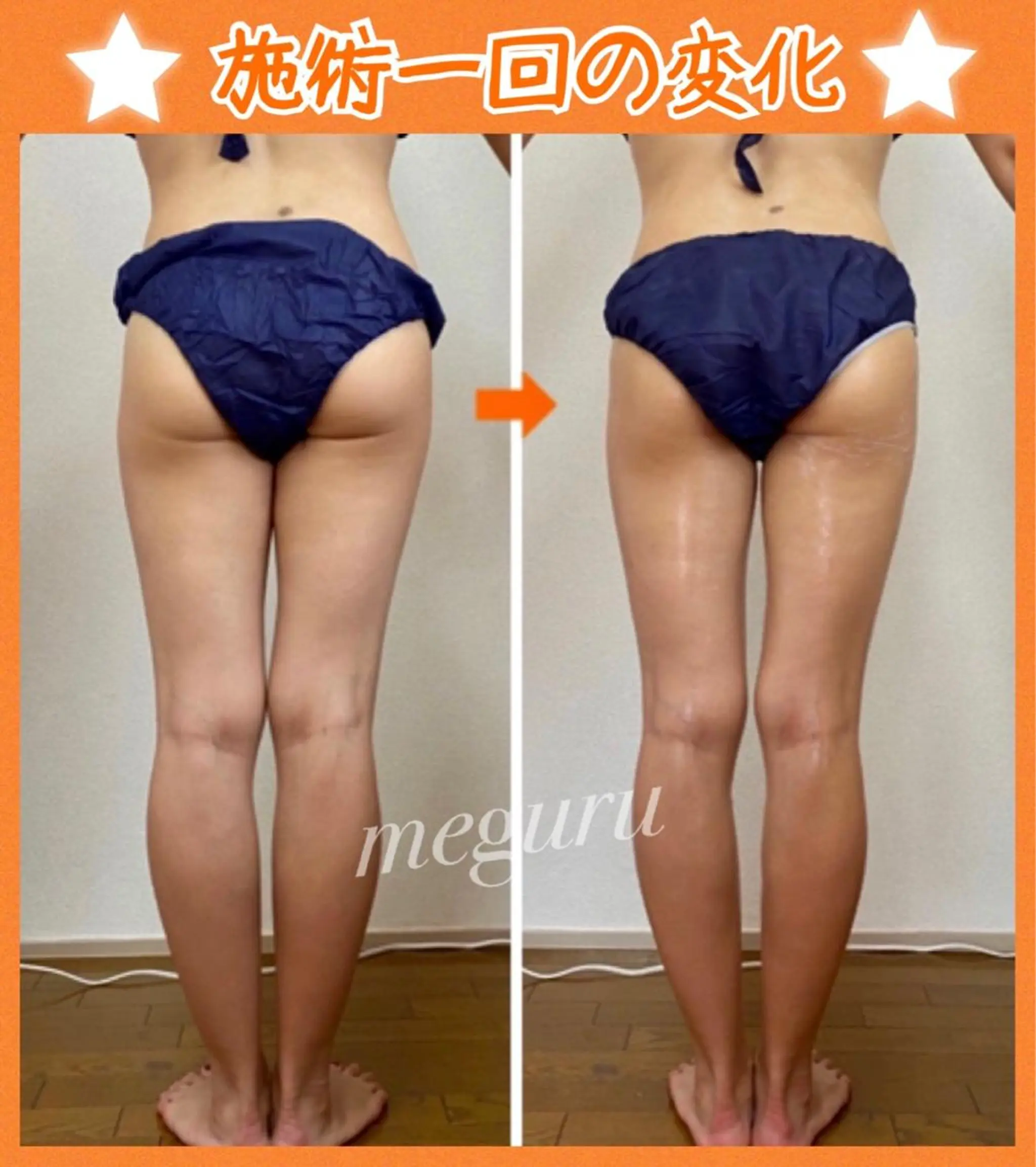 ショート カラー パーマ ヘアアレンジ メンズ キッズ ネイル マツエク・マツパ エステ リラク ‍痩身＆ボディ 結果出し🌟丹野のエステ・リラクイメージ