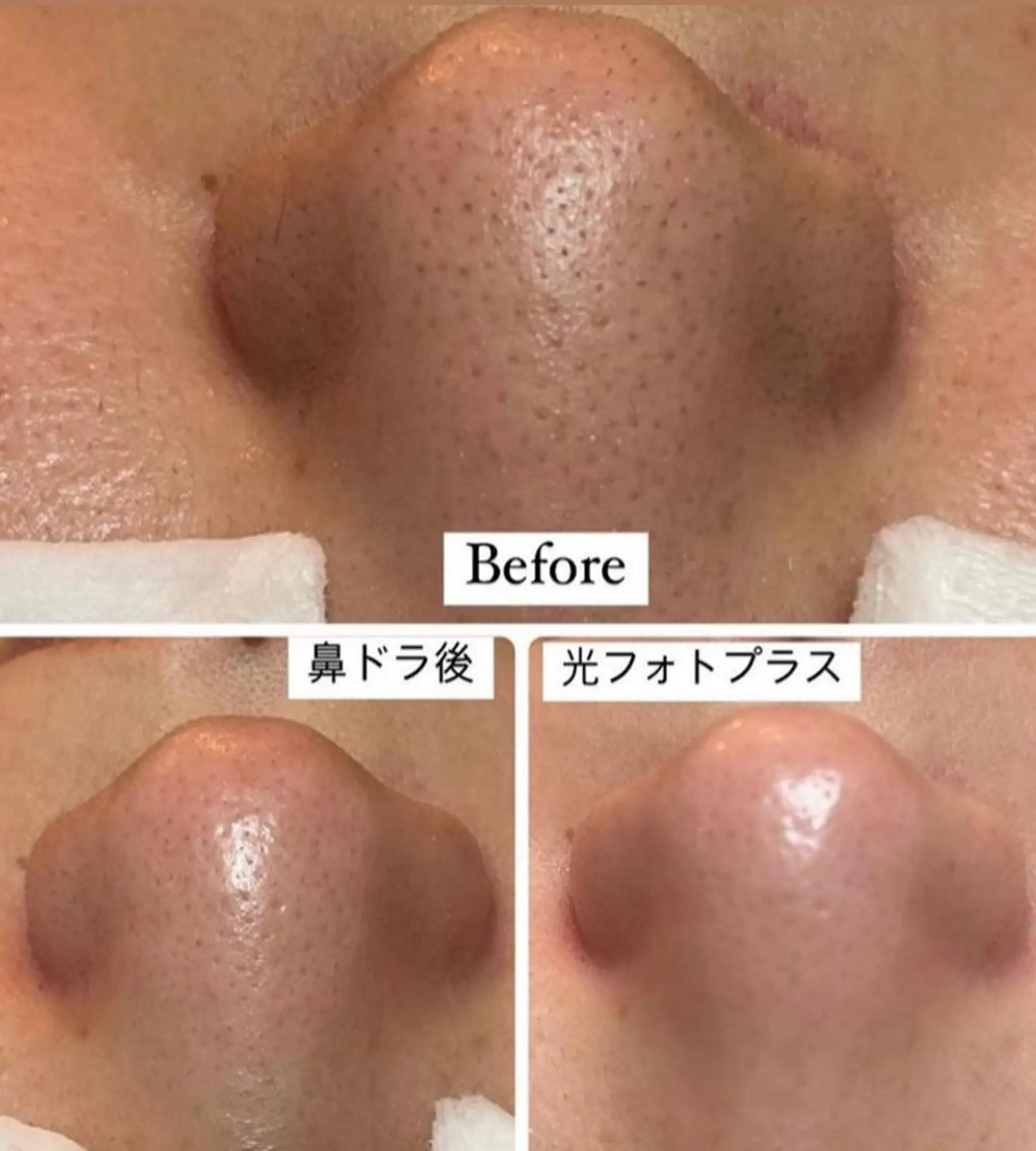 エステ 美顔秘密基地新宮所属・美顔秘密基地 新宮のその他イメージ