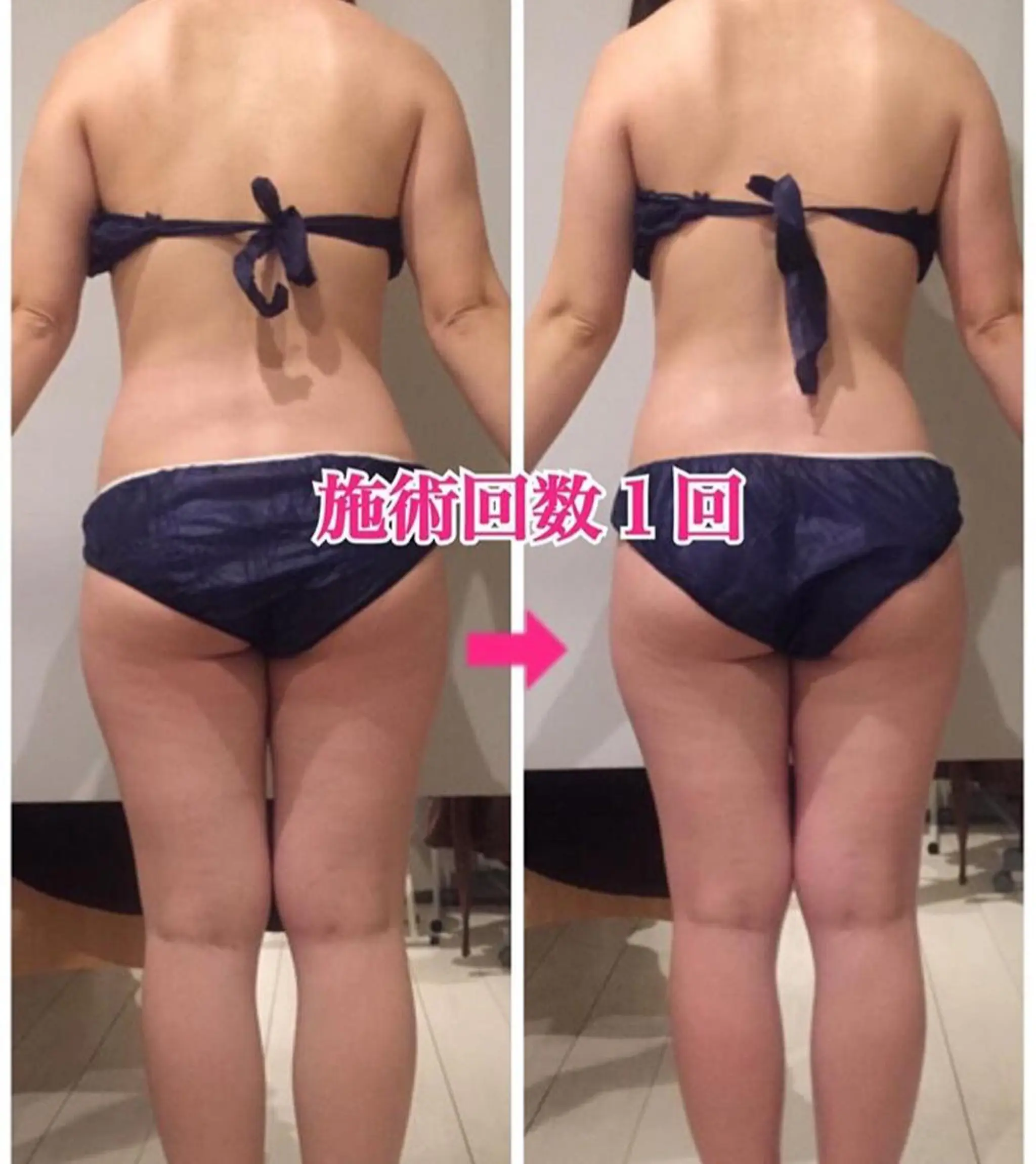 ロング カラー パーマ ヘアアレンジ メンズ キッズ ネイル マツエク・マツパ ‍痩身＆ボディ 結果出し🌟丹野のエステ・リラクイメージ