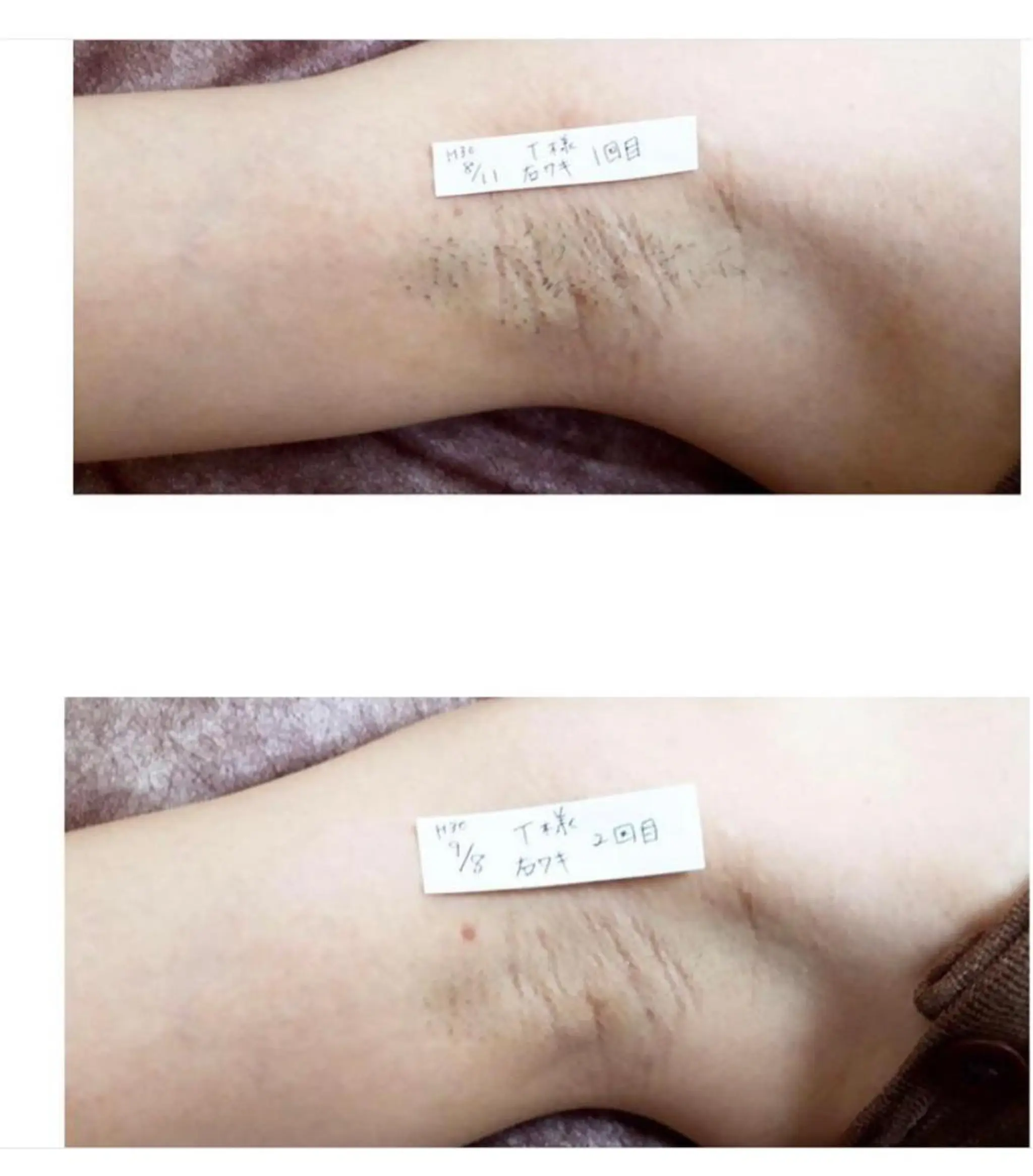 脱毛 Prima〜プリマ〜 名古屋駅店所属・Prima 痩身脱毛 にごうかおりのエステ・リラクイメージ