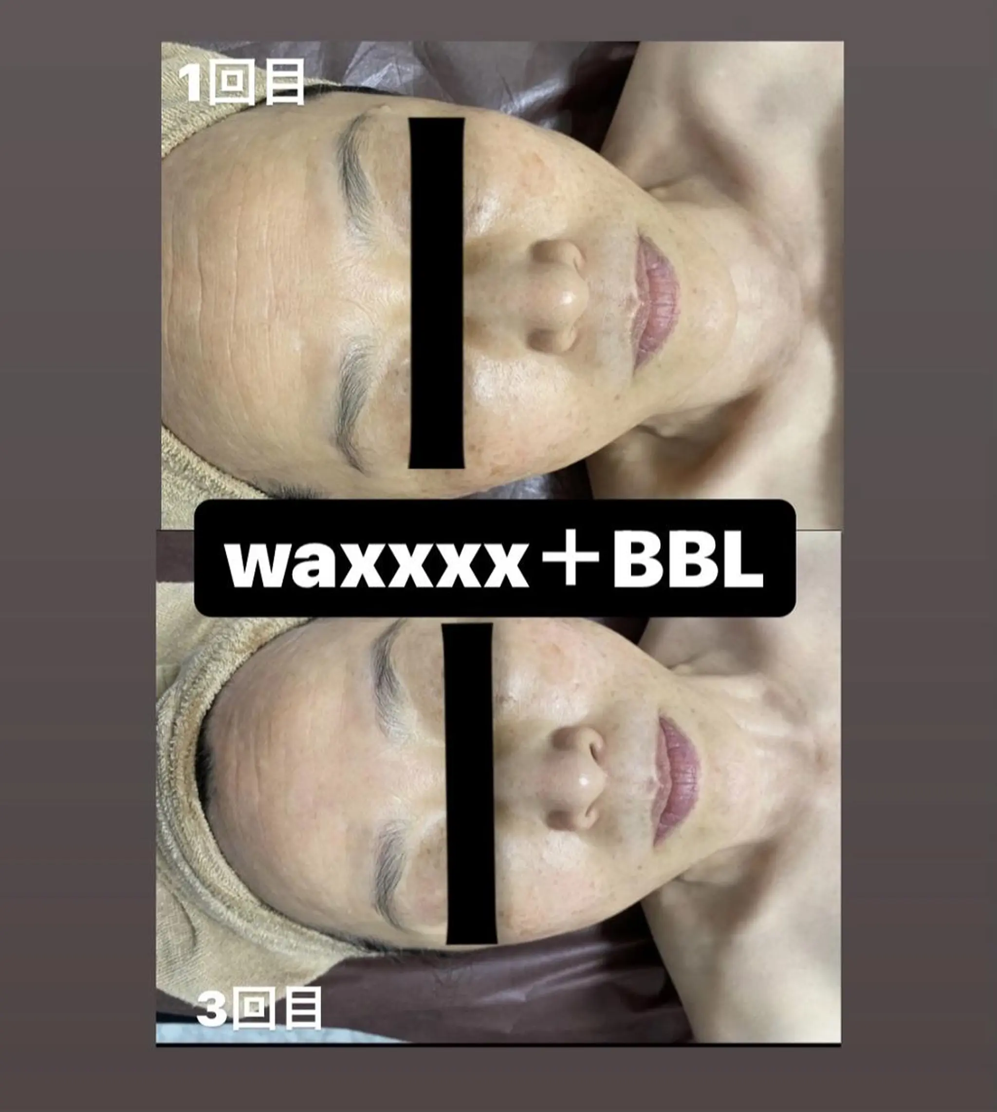 脱毛 Epina 千葉店 【エピナ】のエステ・リラクイメージ