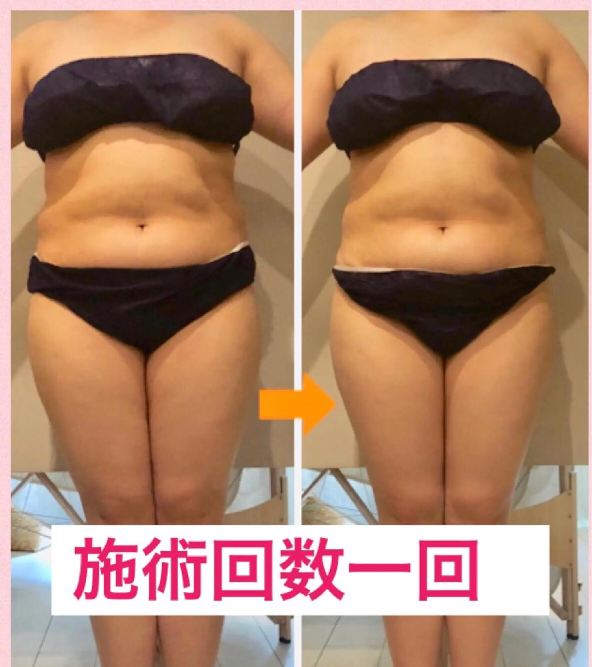 ロング カラー パーマ ヘアアレンジ メンズ キッズ ネイル マツエク・マツパ マットネイル 赤色 ‍痩身＆ボディ 結果出し🌟丹野のエステ・リラクイメージ