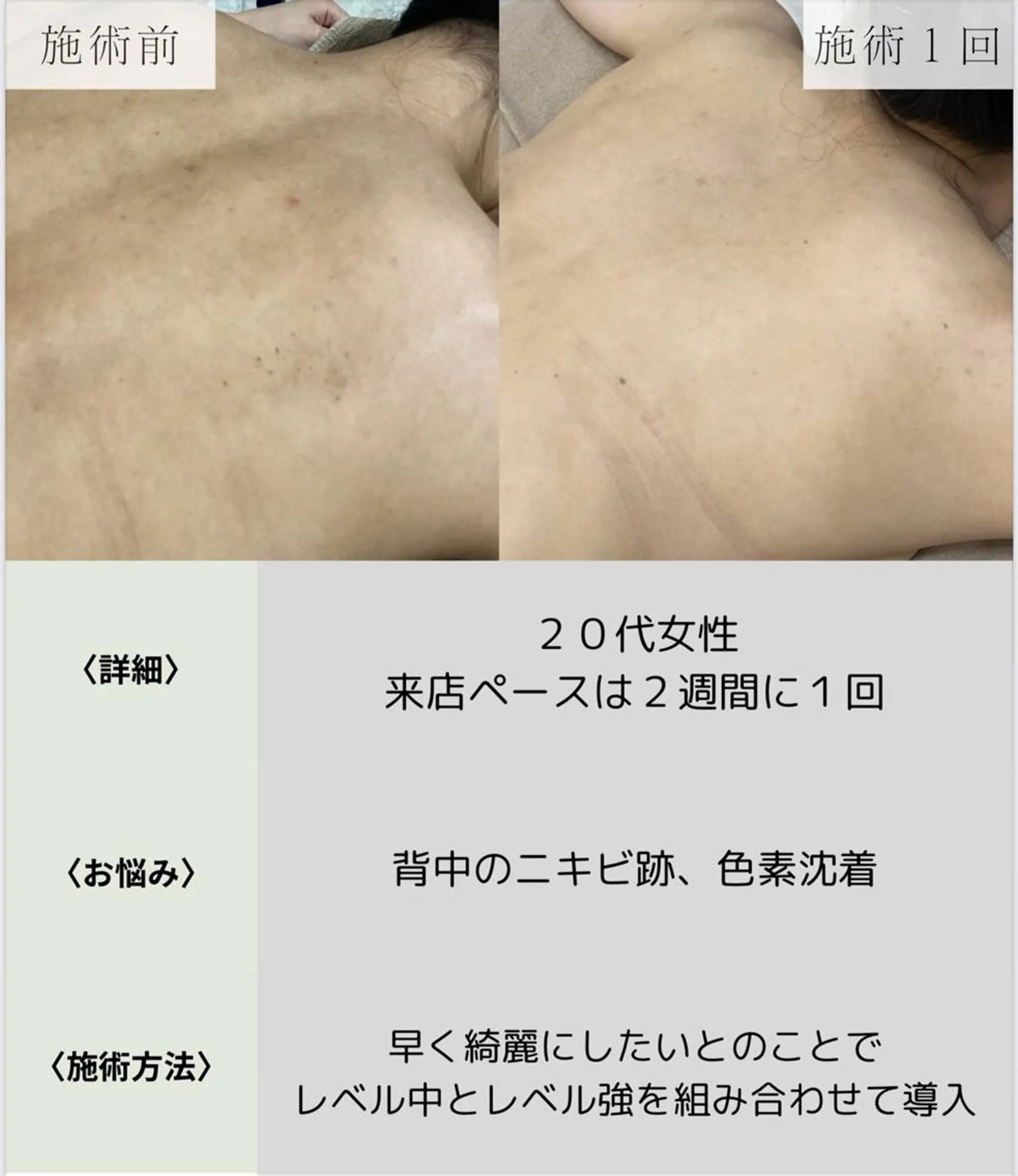 脱毛・眉毛・フェイス サロンN久留米店のその他イメージ