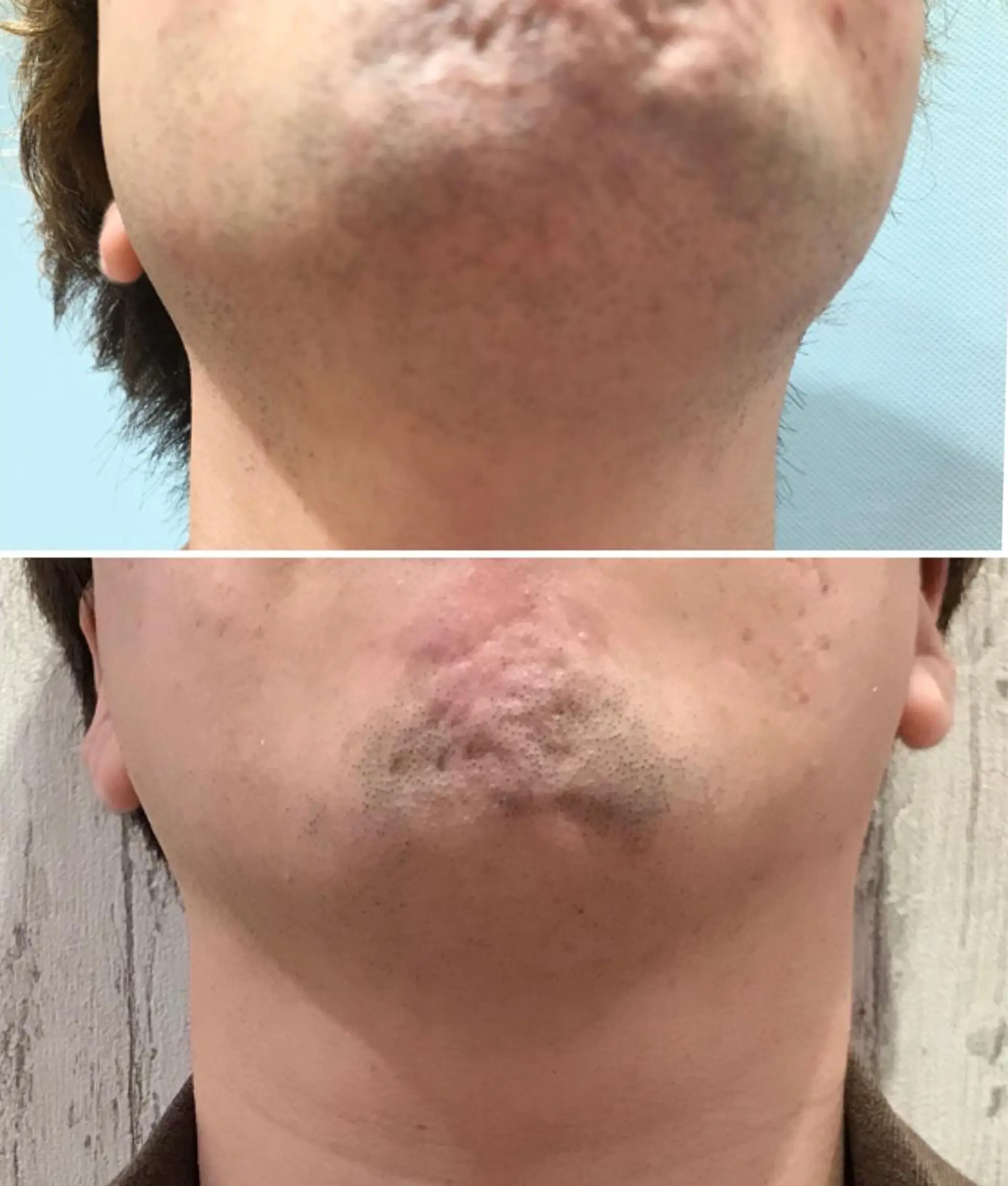 メンズ 脱毛 【EARTH鳥栖店】 小松美穂子のエステ・リラクイメージ