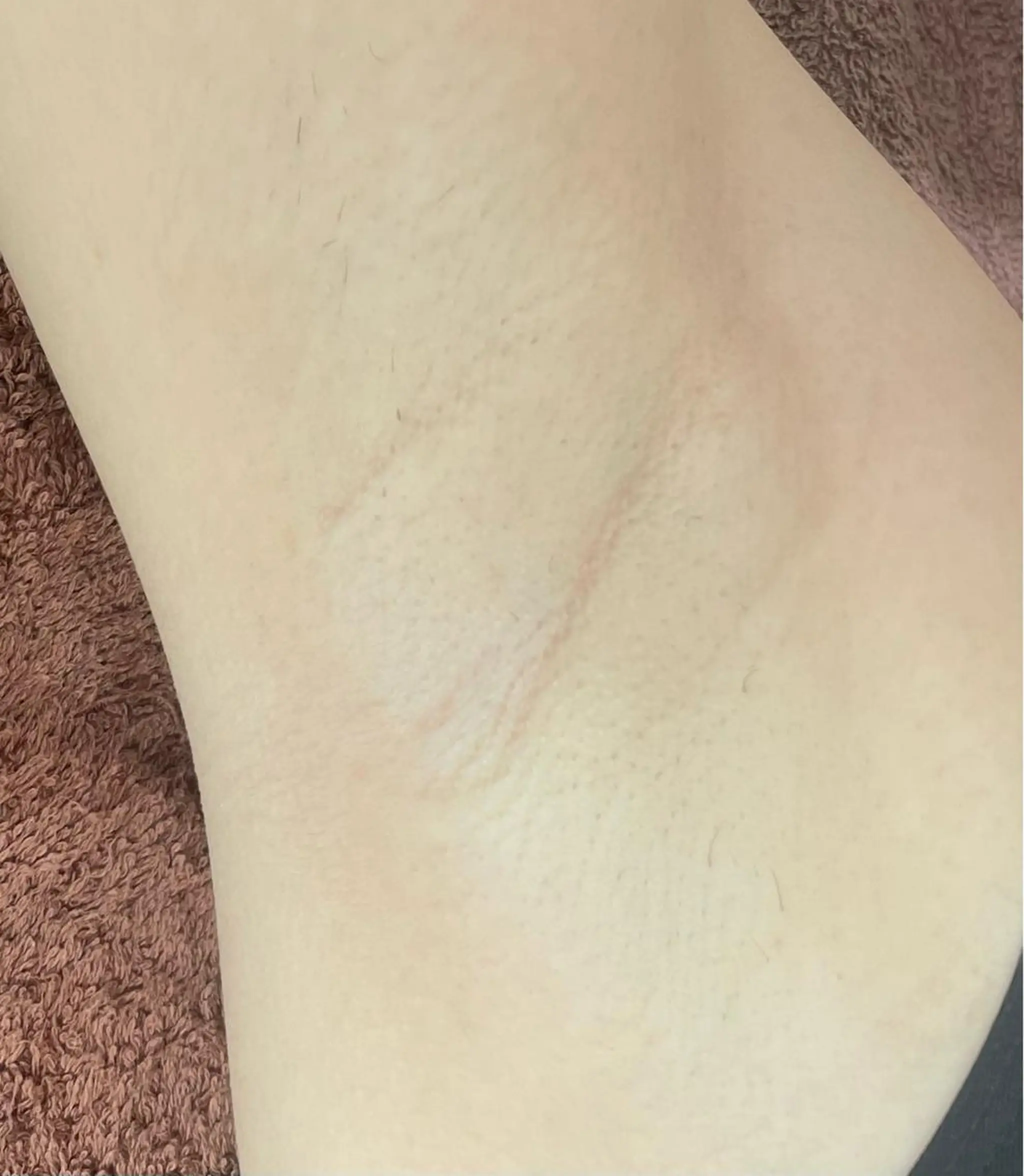 脱毛 LY SALON所属・LY　SALON♡ トータルビューティーのエステ・リラクイメージ