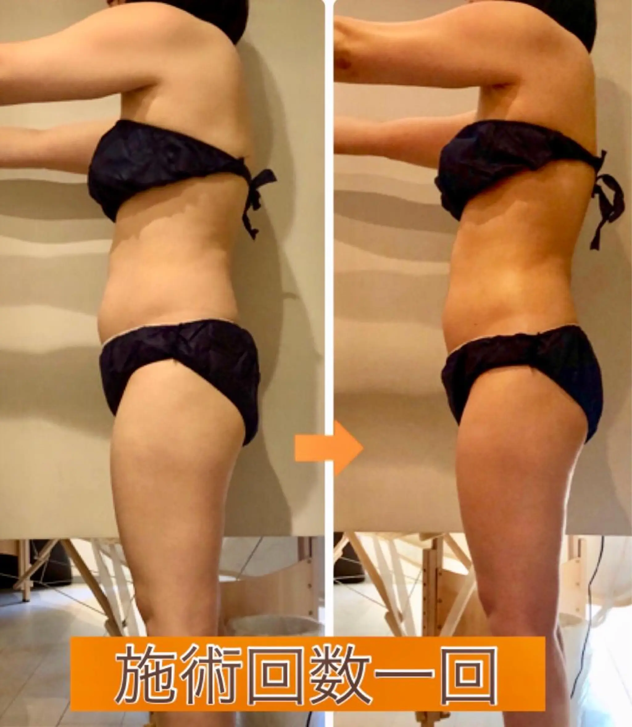 ロング カラー パーマ ヘアアレンジ メンズ キッズ ネイル マツエク・マツパ ‍痩身＆ボディ 結果出し🌟丹野のエステ・リラクイメージ