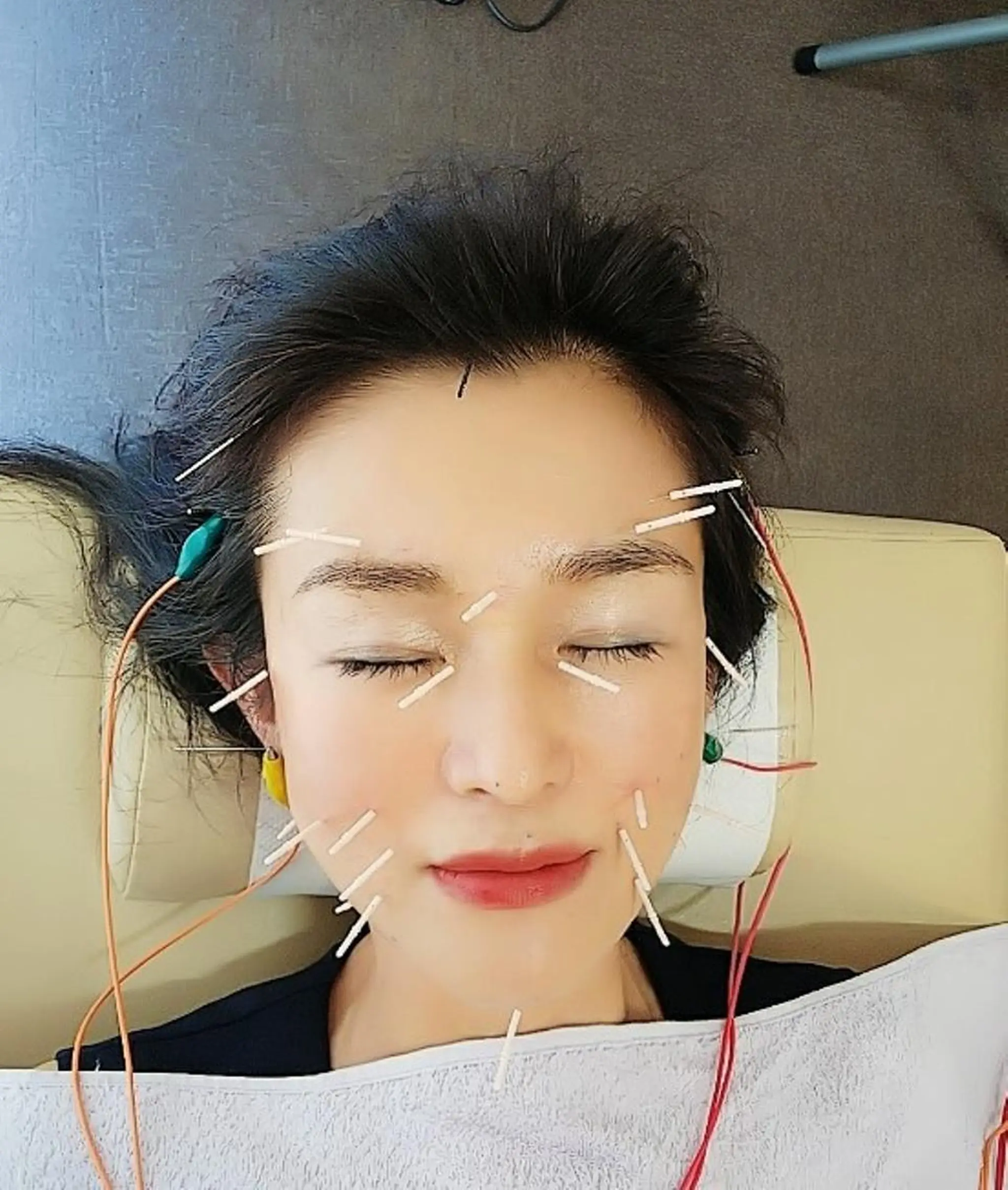 エステ リラク お顔のむくみたるみ 専門☆美容鍼小顔矯正のエステ・リラクイメージ