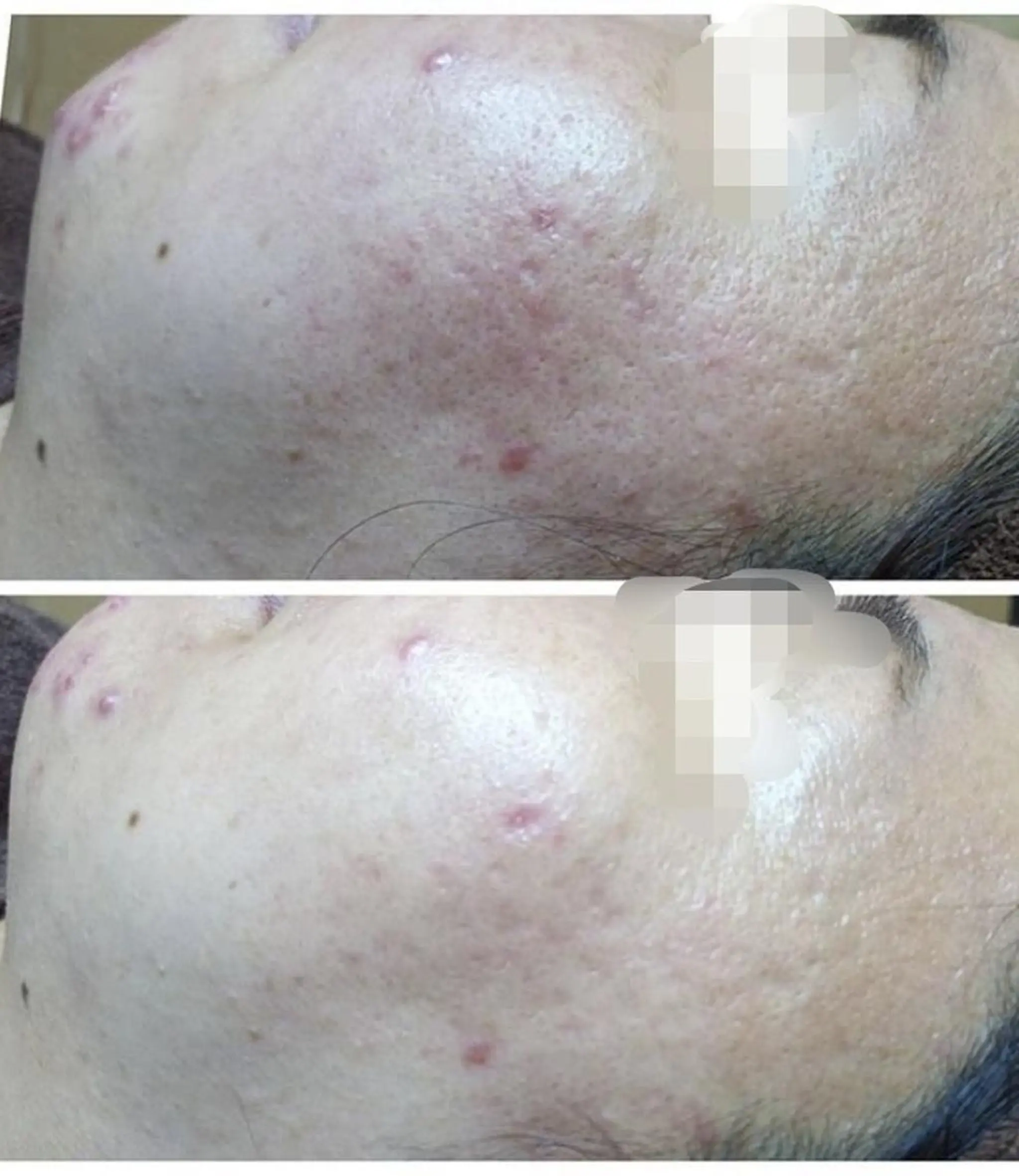 EYE LASH LAPISのエステ・リラクイメージ