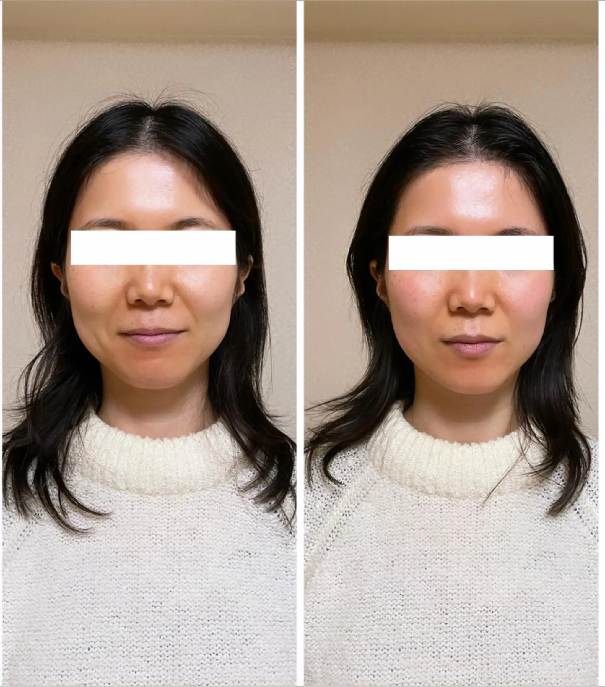 自律神経を整える フェイシャルエステのエステ・リラクイメージ