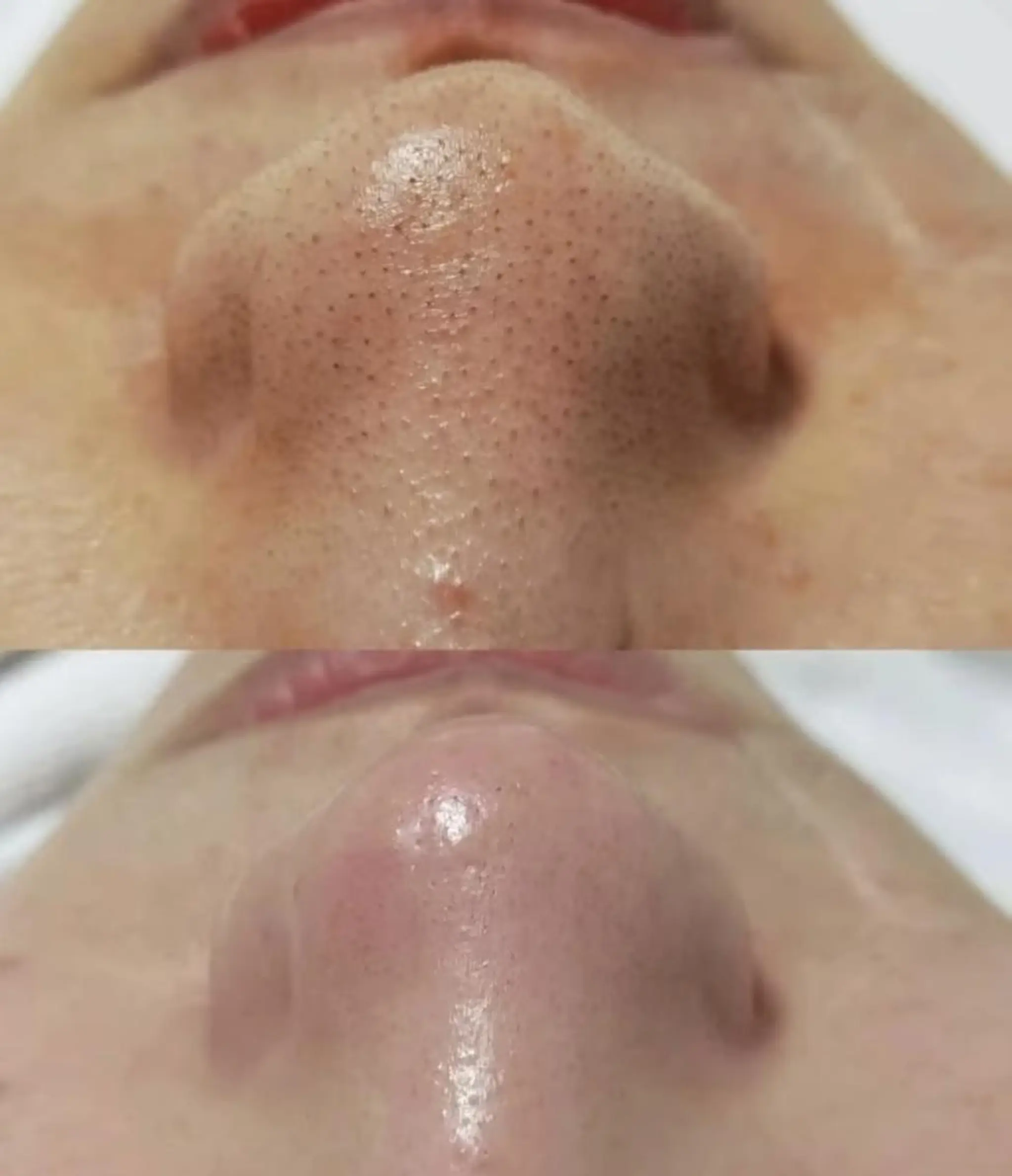 U・mi ユキのマツエク・マツパデザイン