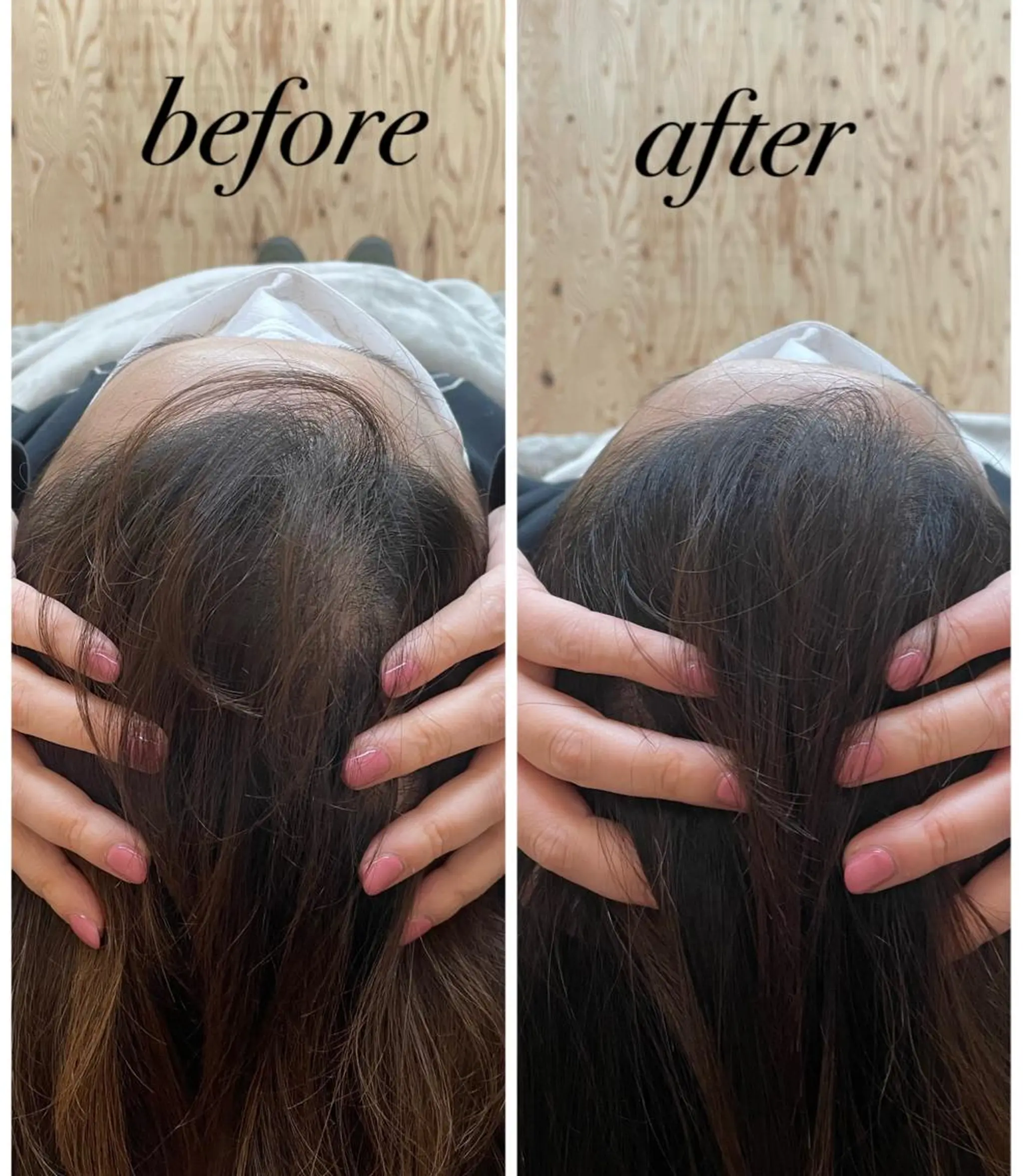 リラク ate'所属・個室ドライヘッドスパ 🍃moriのエステ・リラクイメージ