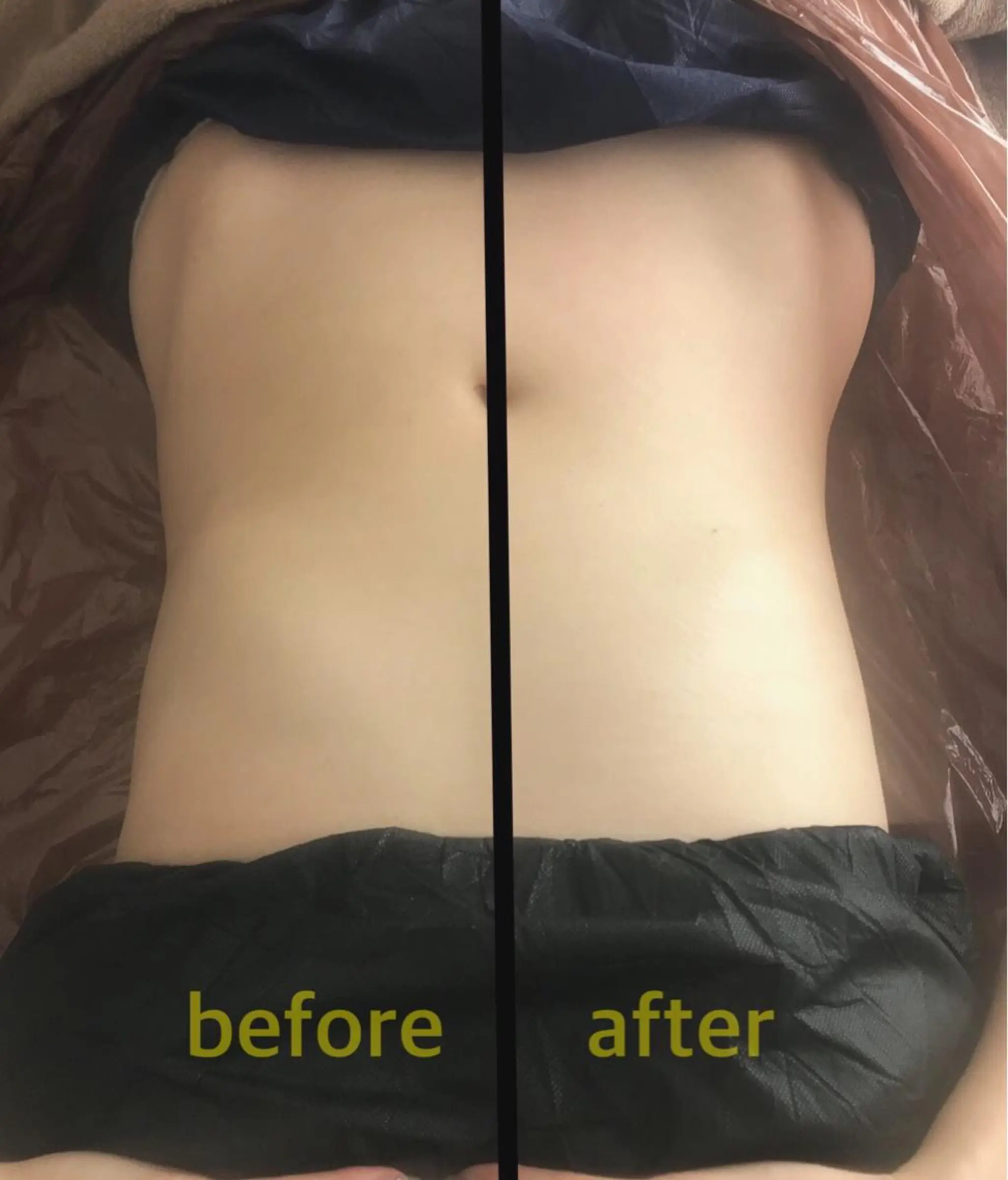 biloop所属・《痩身×疲労改善》 BILOOPのエステ・リラクイメージ