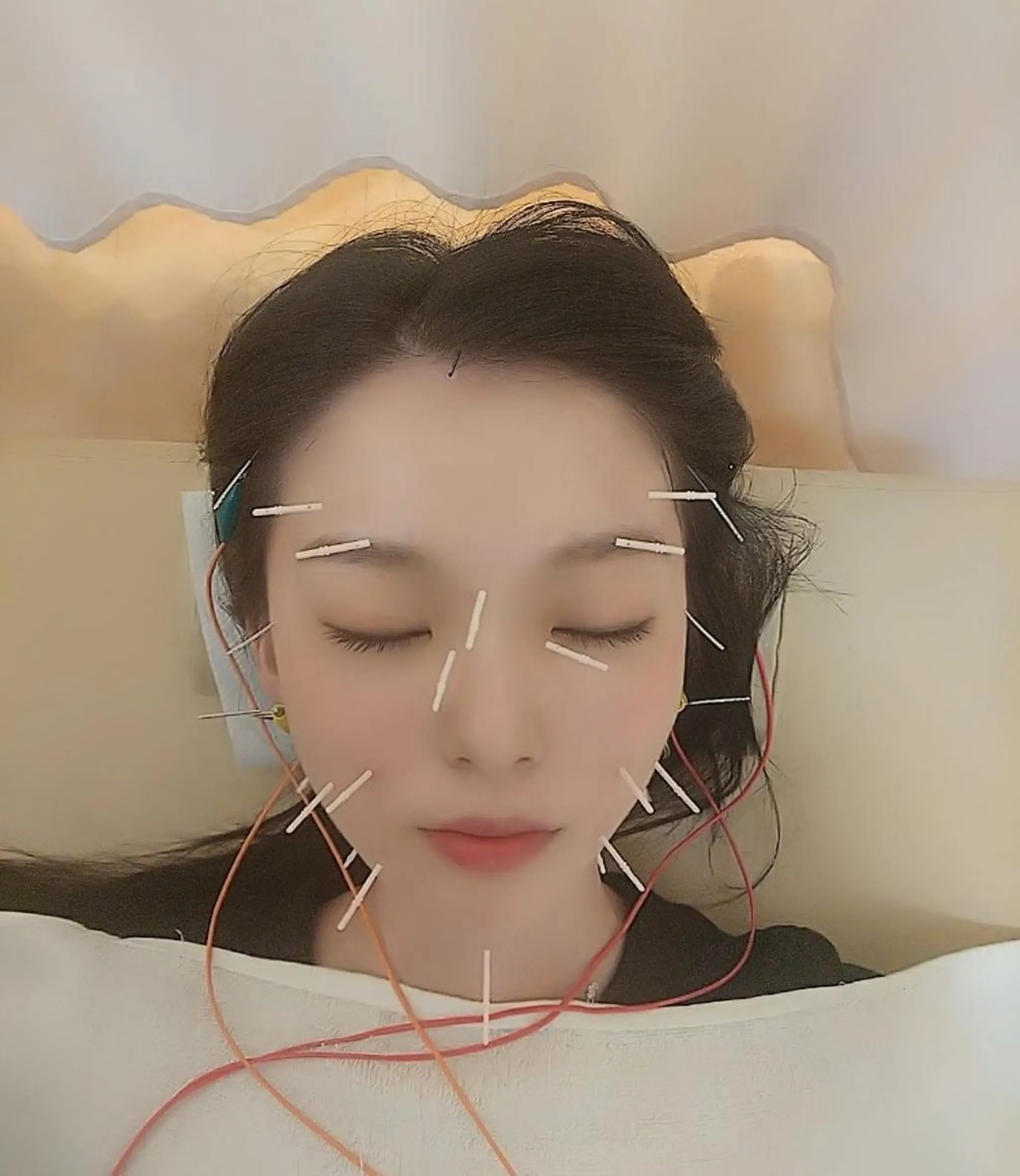 お顔のむくみたるみ 専門☆美容鍼小顔矯正のエステ・リラクイメージ