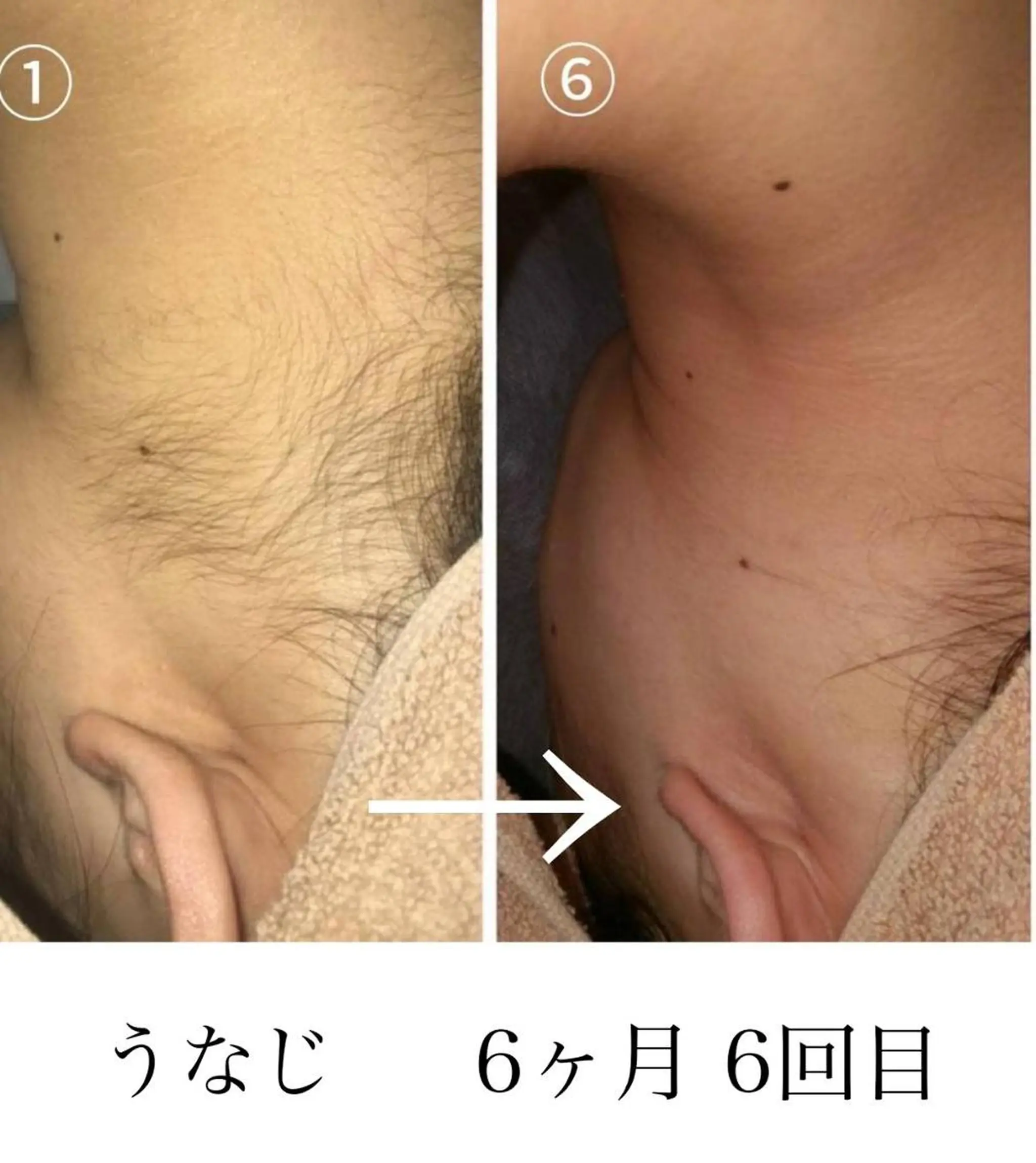 脱毛・眉毛・フェイス サロンN久留米店の眉毛・アイブロウイメージ