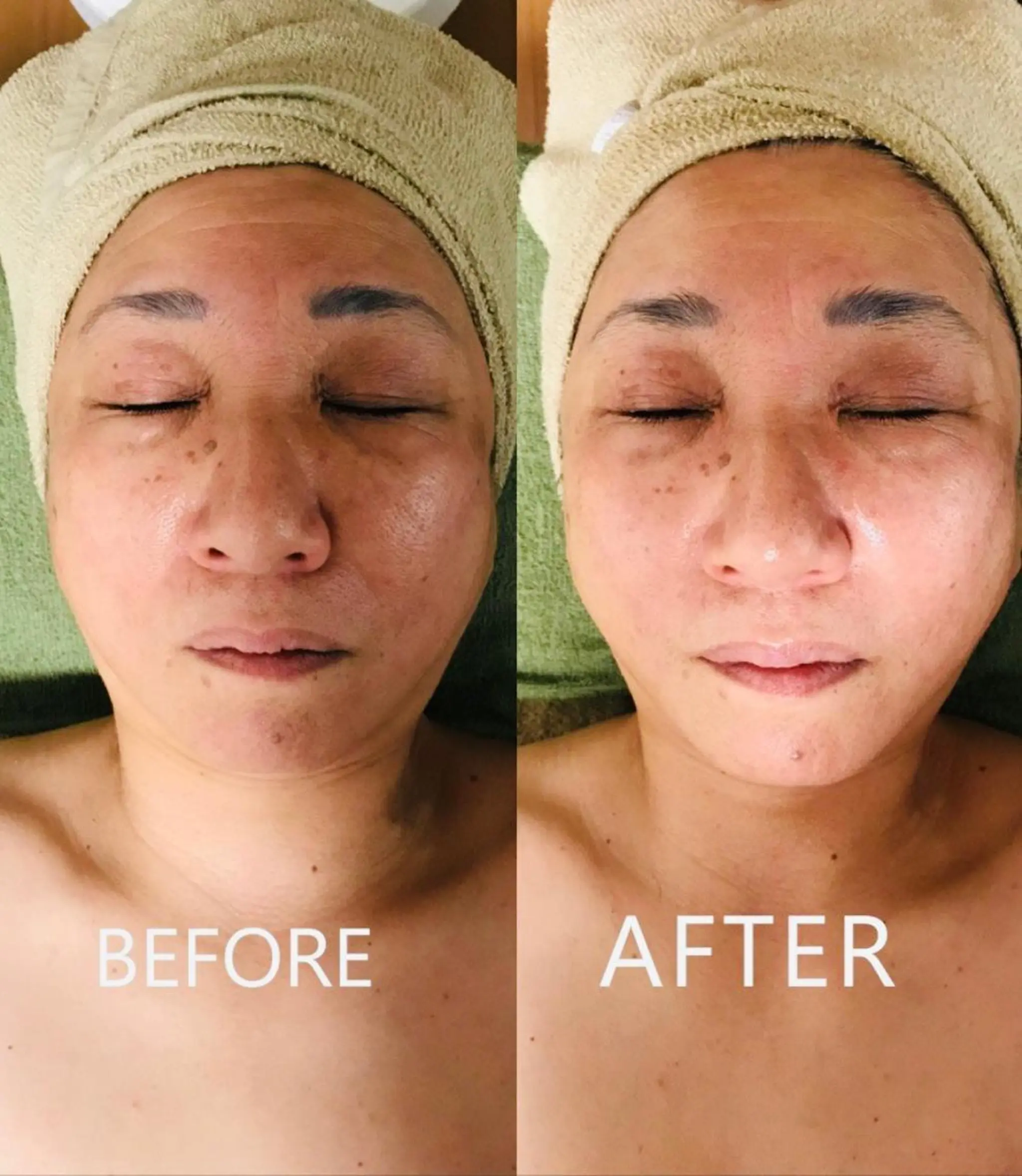 サロンur（ユア） Rieのエステ・リラクイメージ