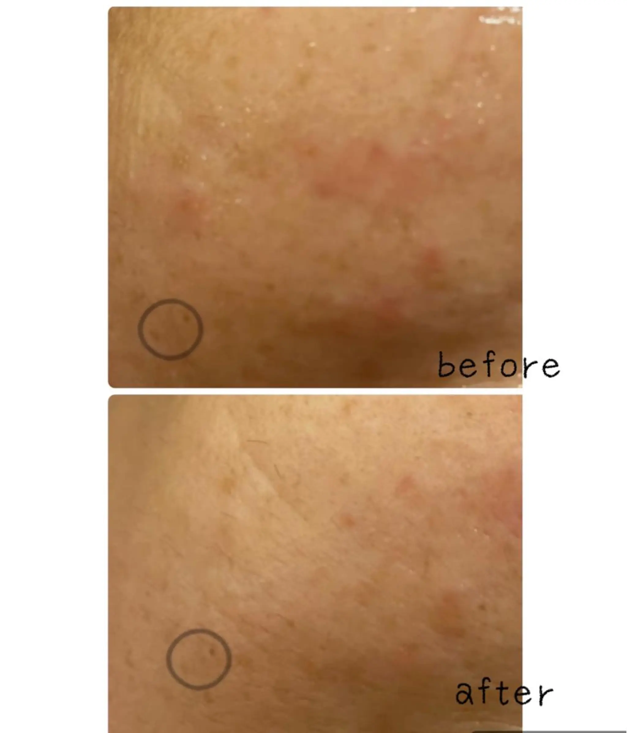 美まつ毛と美肌サロン lavjuのマツエク・マツパデザイン