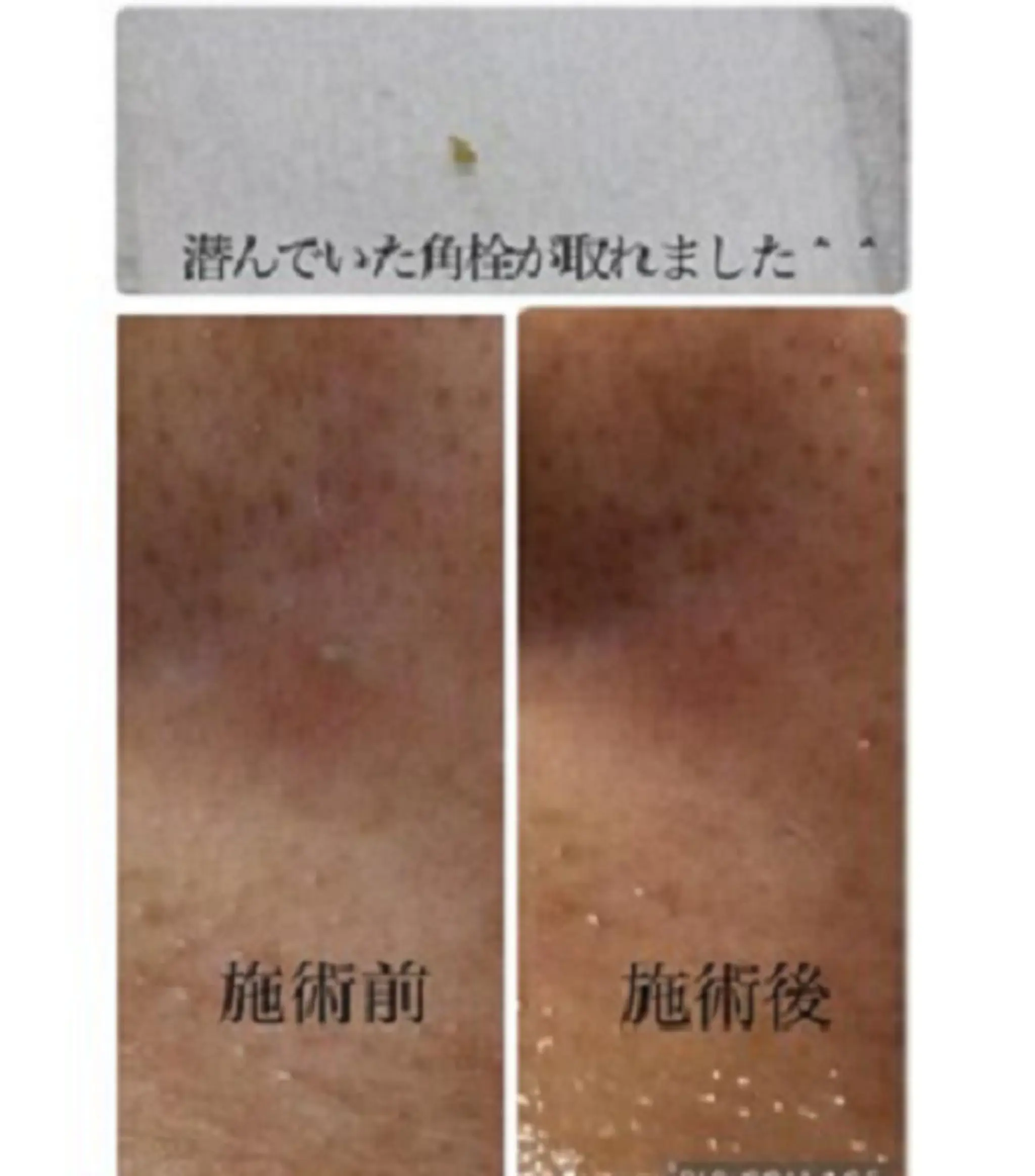 エステ BUHTI本八幡 Okudairaのエステ・リラクイメージ