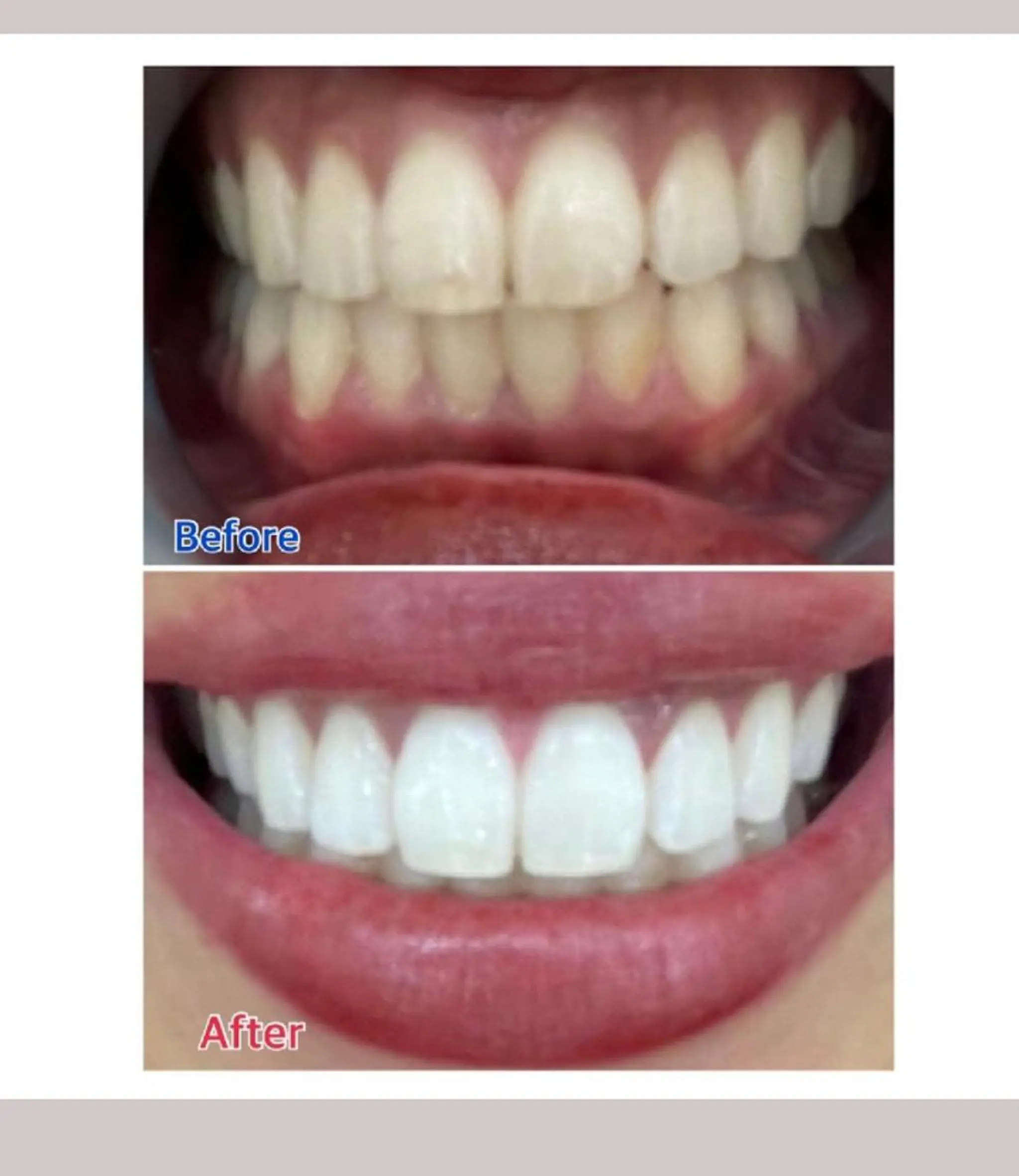 M渋谷店所属・M渋谷 ホワイトニングのエステ・リラクイメージ