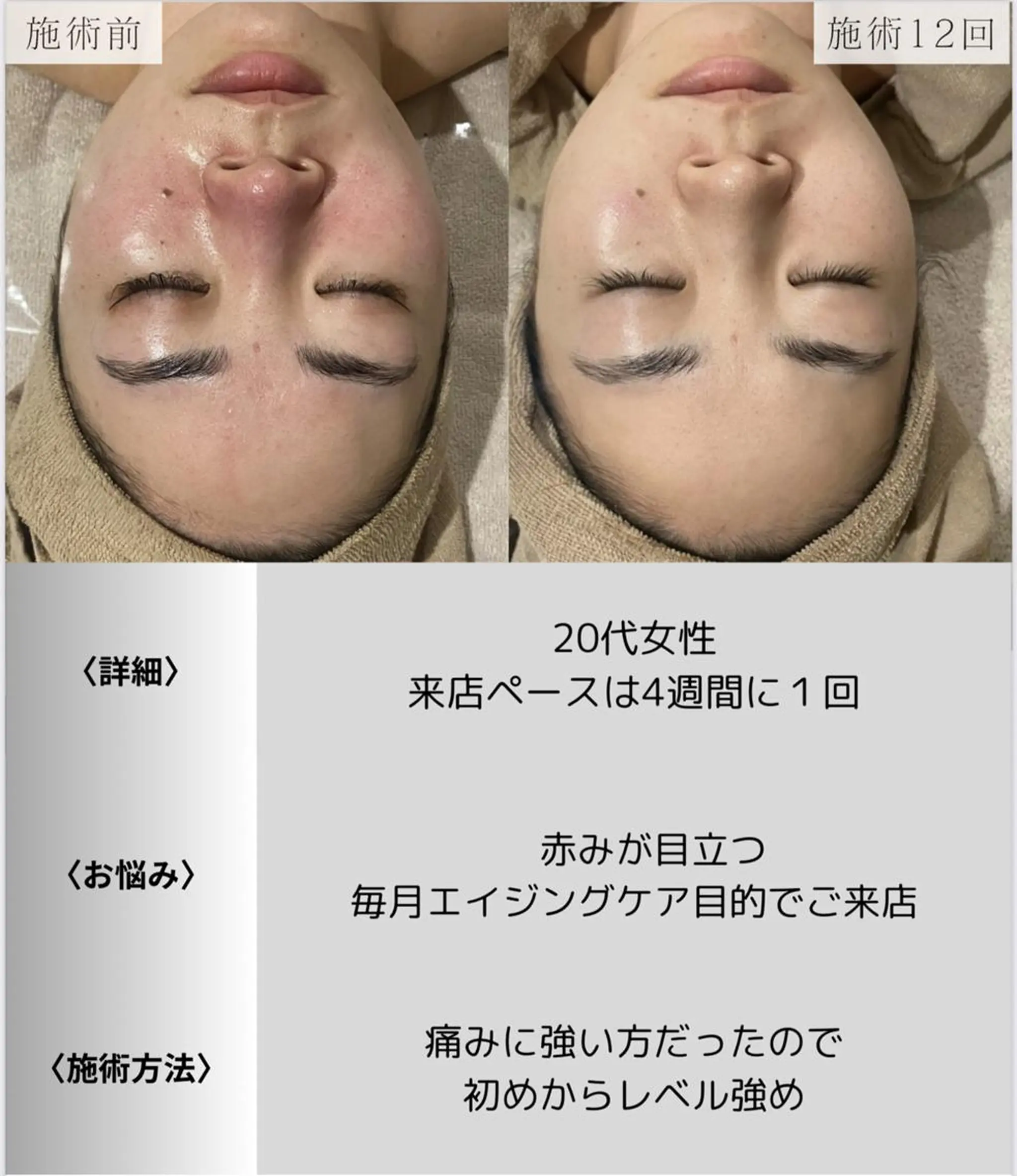 脱毛・眉毛・フェイス サロンN久留米店のその他イメージ