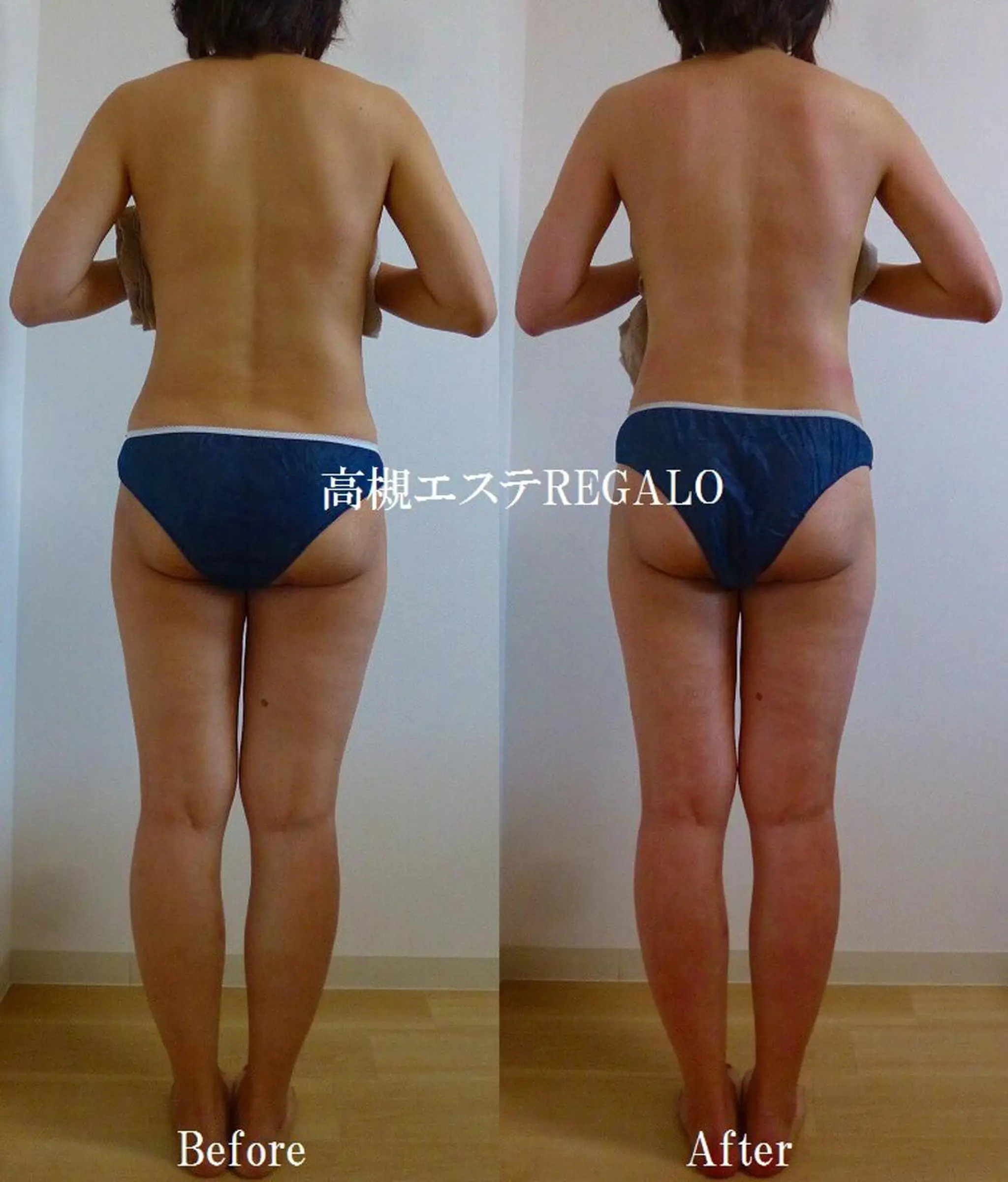 エステ REGALO所属・矢野 さやかのエステ・リラクイメージ