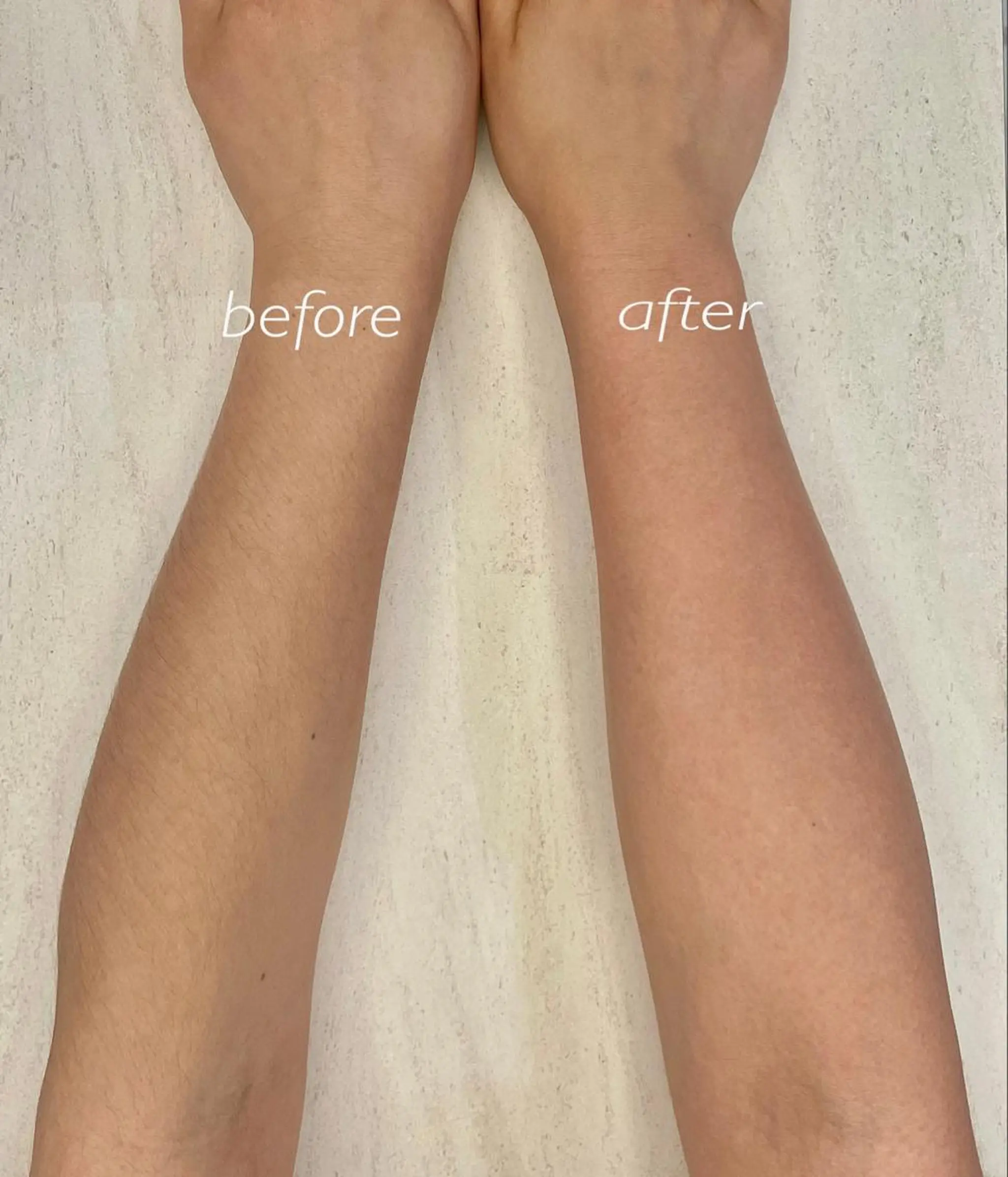 脱毛 ナチュピ所属・シュガーリングサロン ナチュピのエステ・リラクイメージ