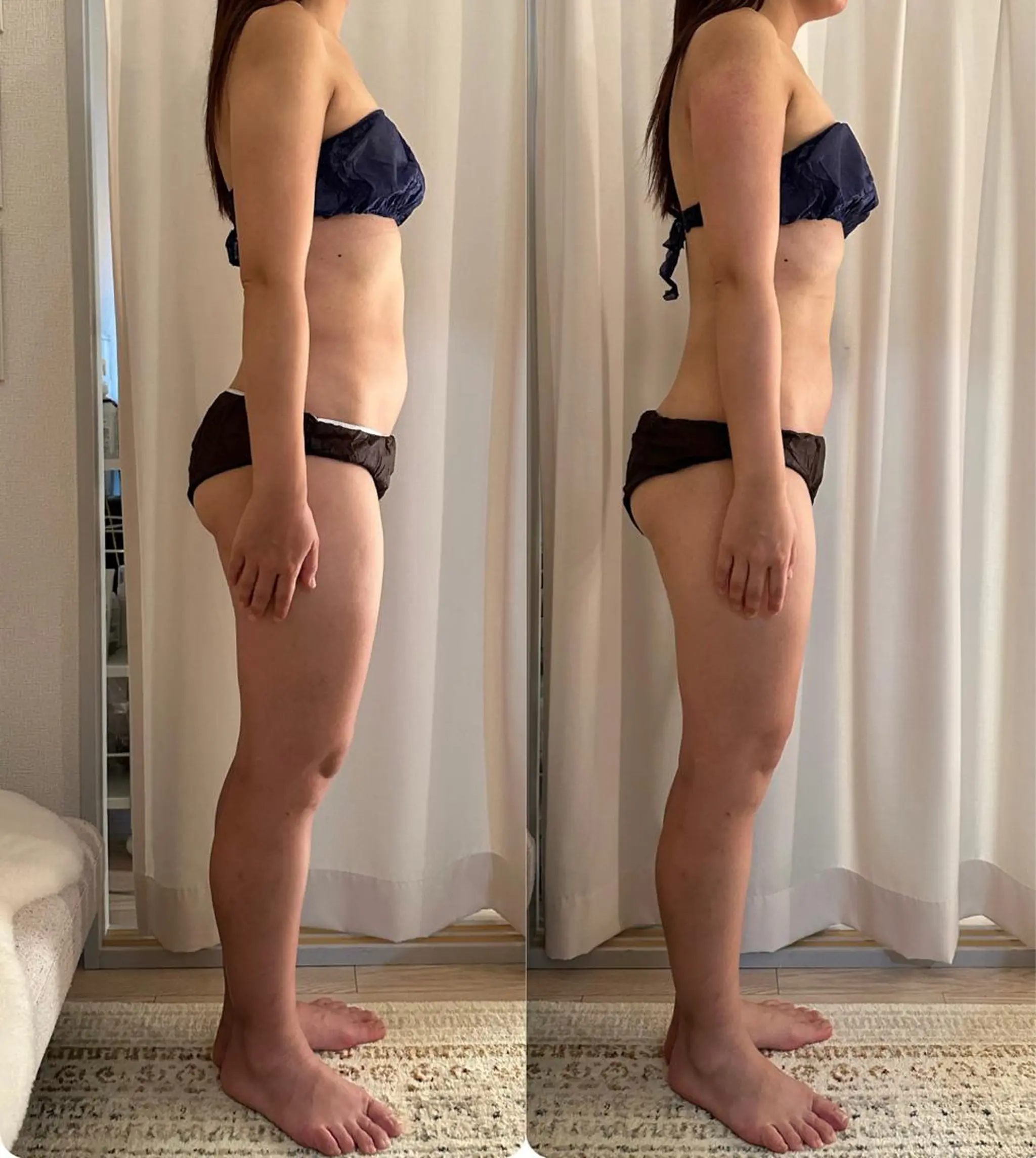 エステ 美容鍼灸サロンRemeリミー所属・美容鍼WINBACK サロンRemeのエステ・リラクイメージ