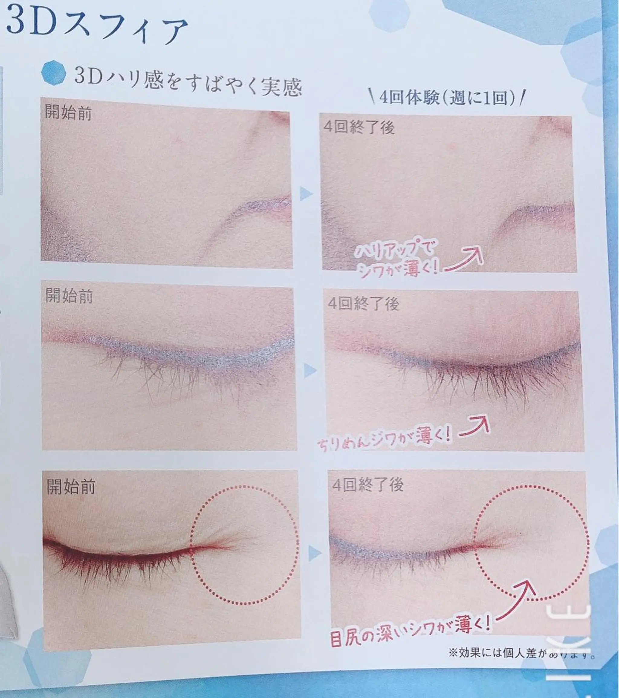 skinLabo所属・saya Mのエステ・リラクイメージ