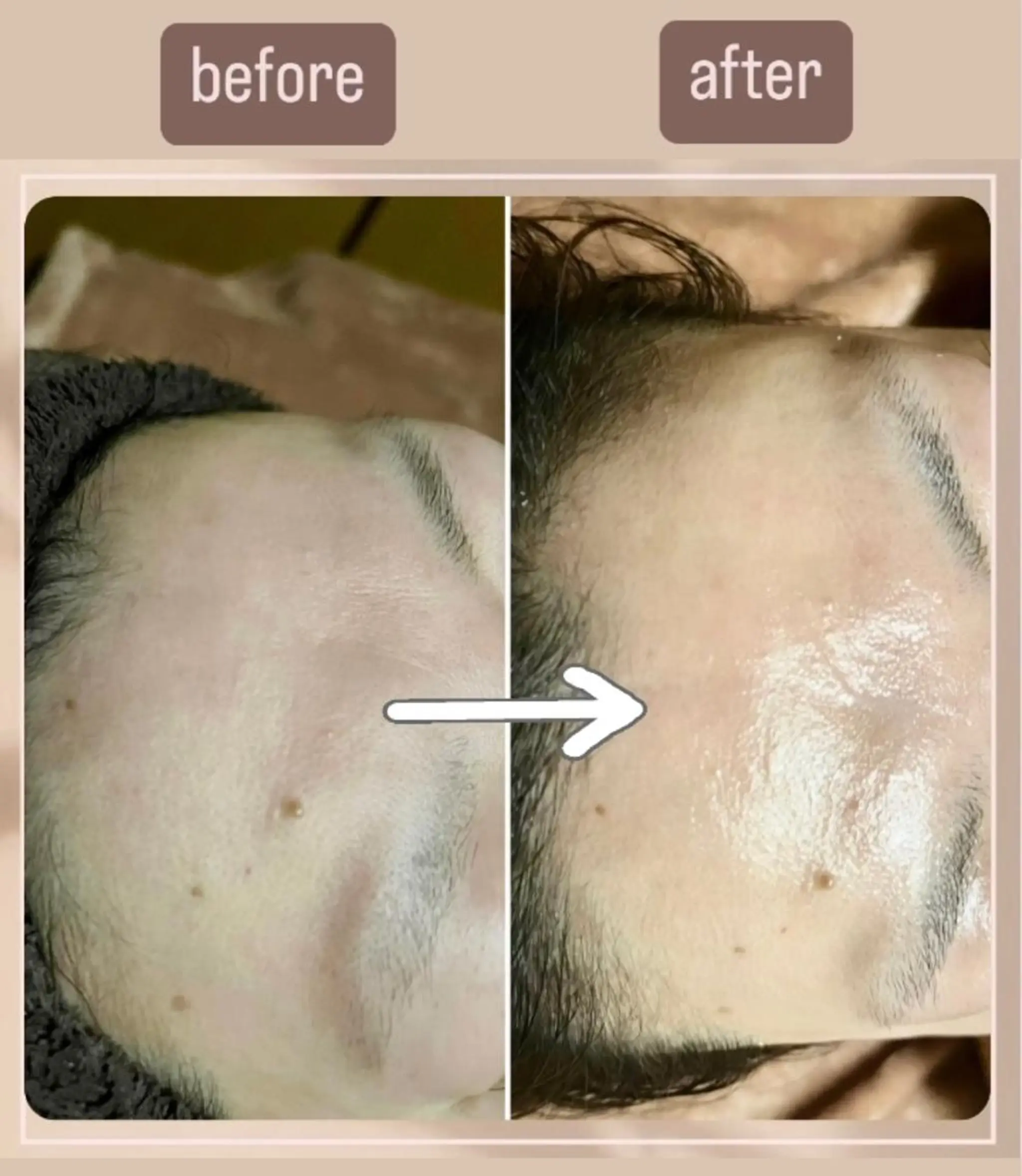 アイカワールド所属・鈴木 愛加のエステ・リラクイメージ