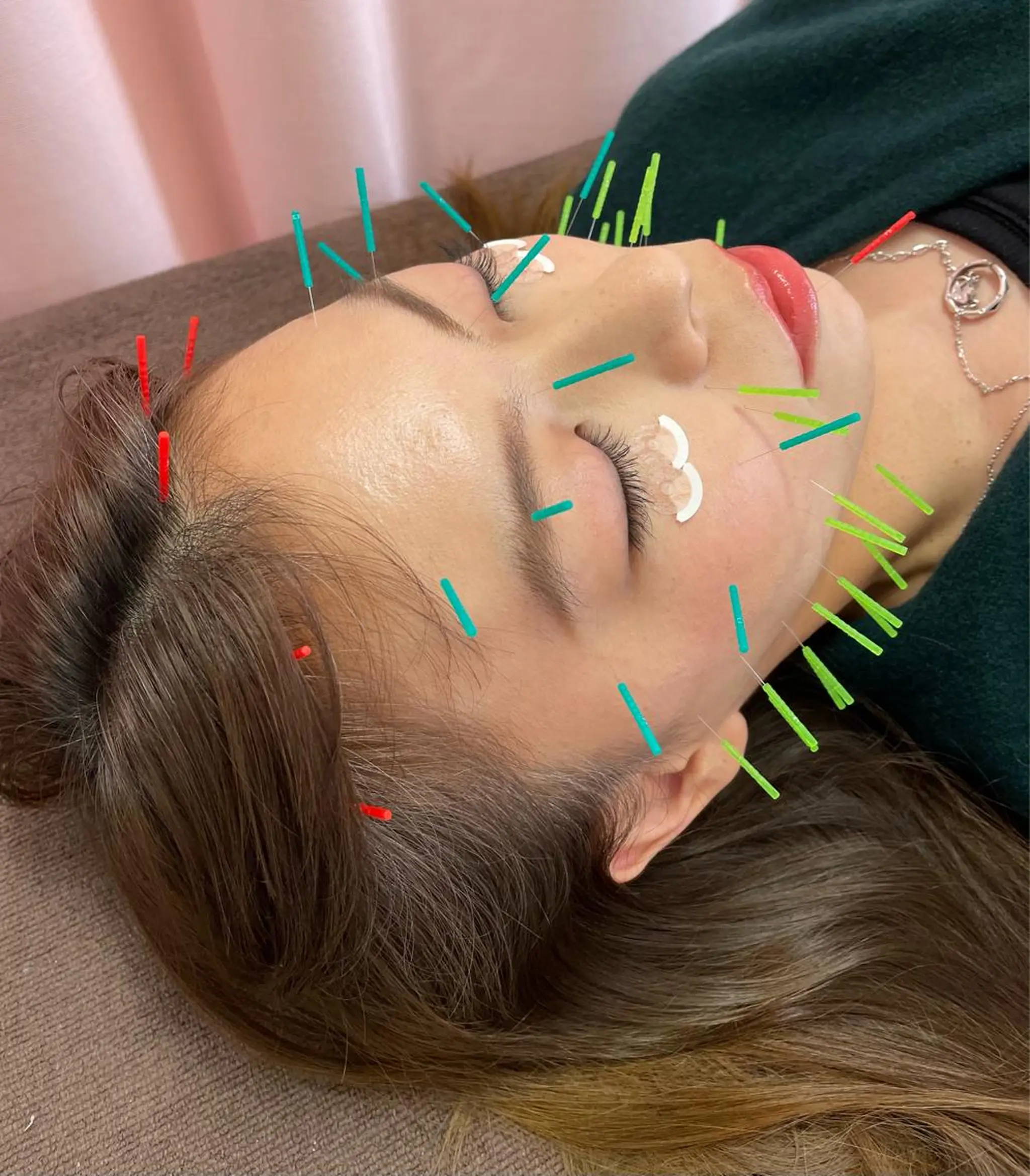 同心整骨院 美容鍼・整体・小顔のエステ・リラクイメージ