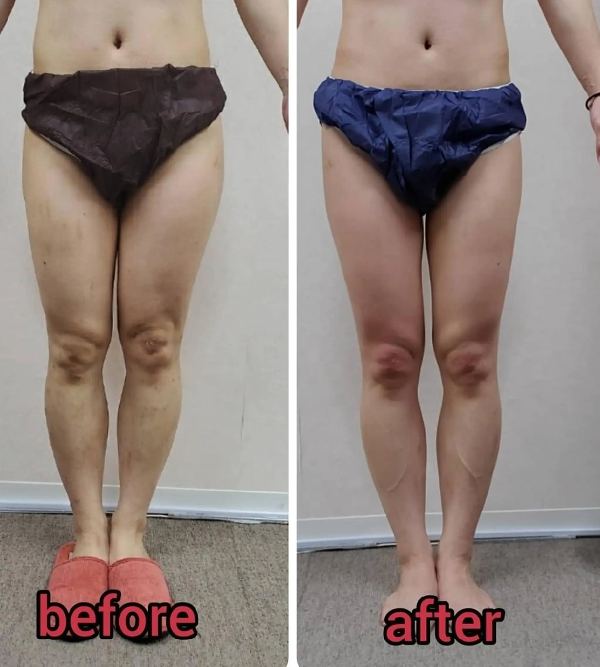 エステ リラク 【 Laforme】 ラ・フォルムのエステ・リラクイメージ