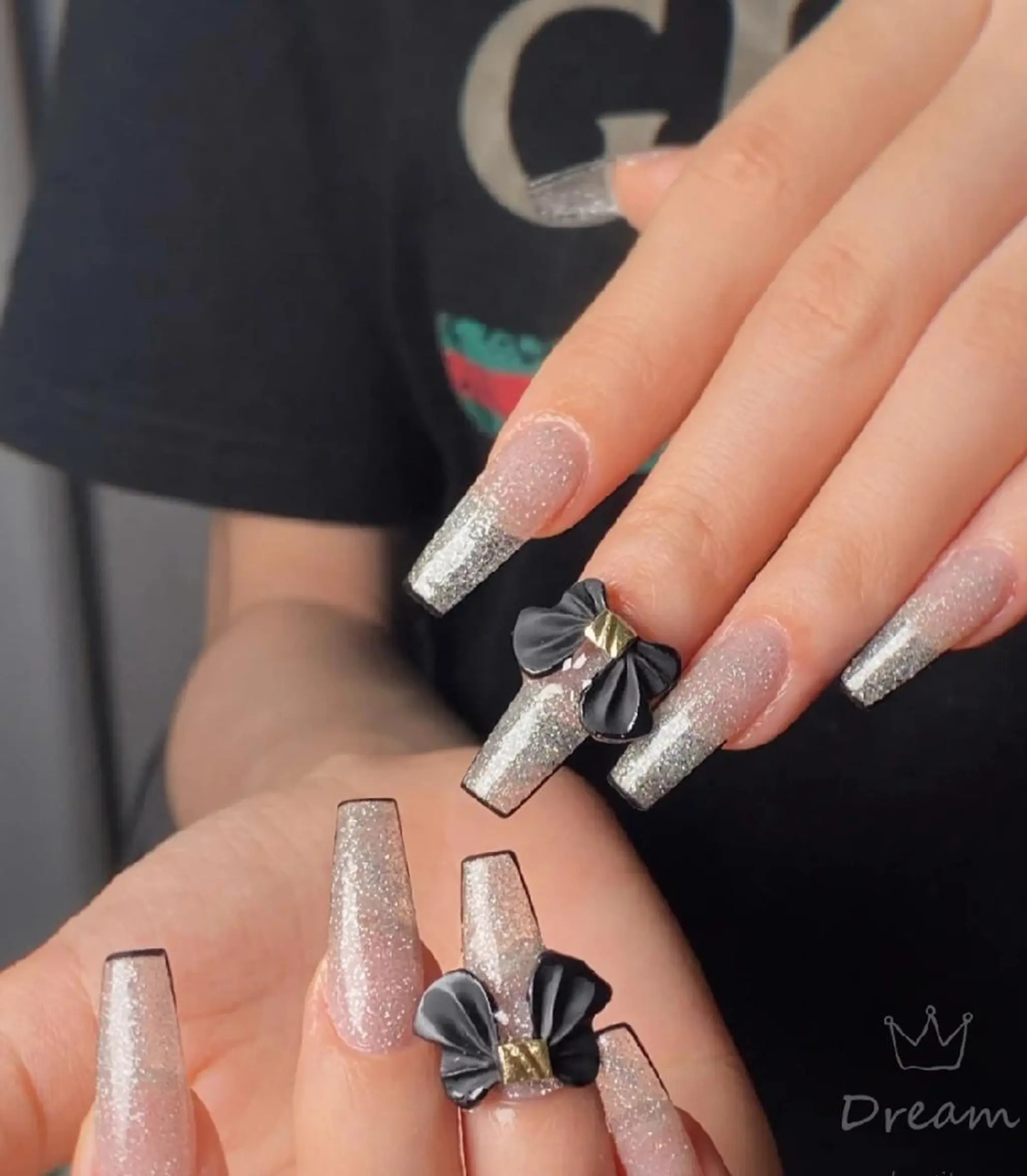 セミロング ネイリストゆか💅 長さだし、深爪矯正のネイルデザイン