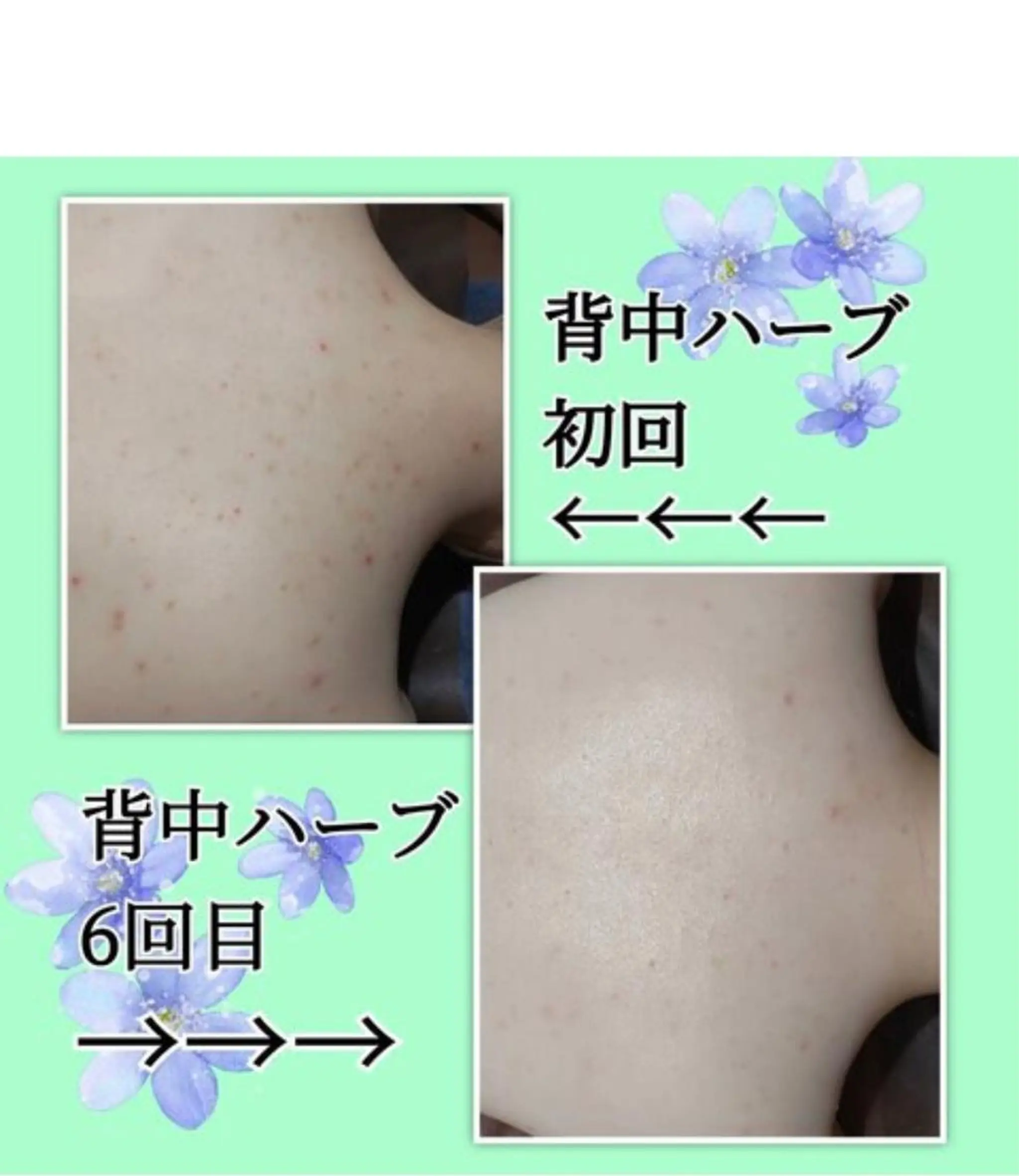 アサヒリラクゼー ション＆エステサロンのエステ・リラクイメージ