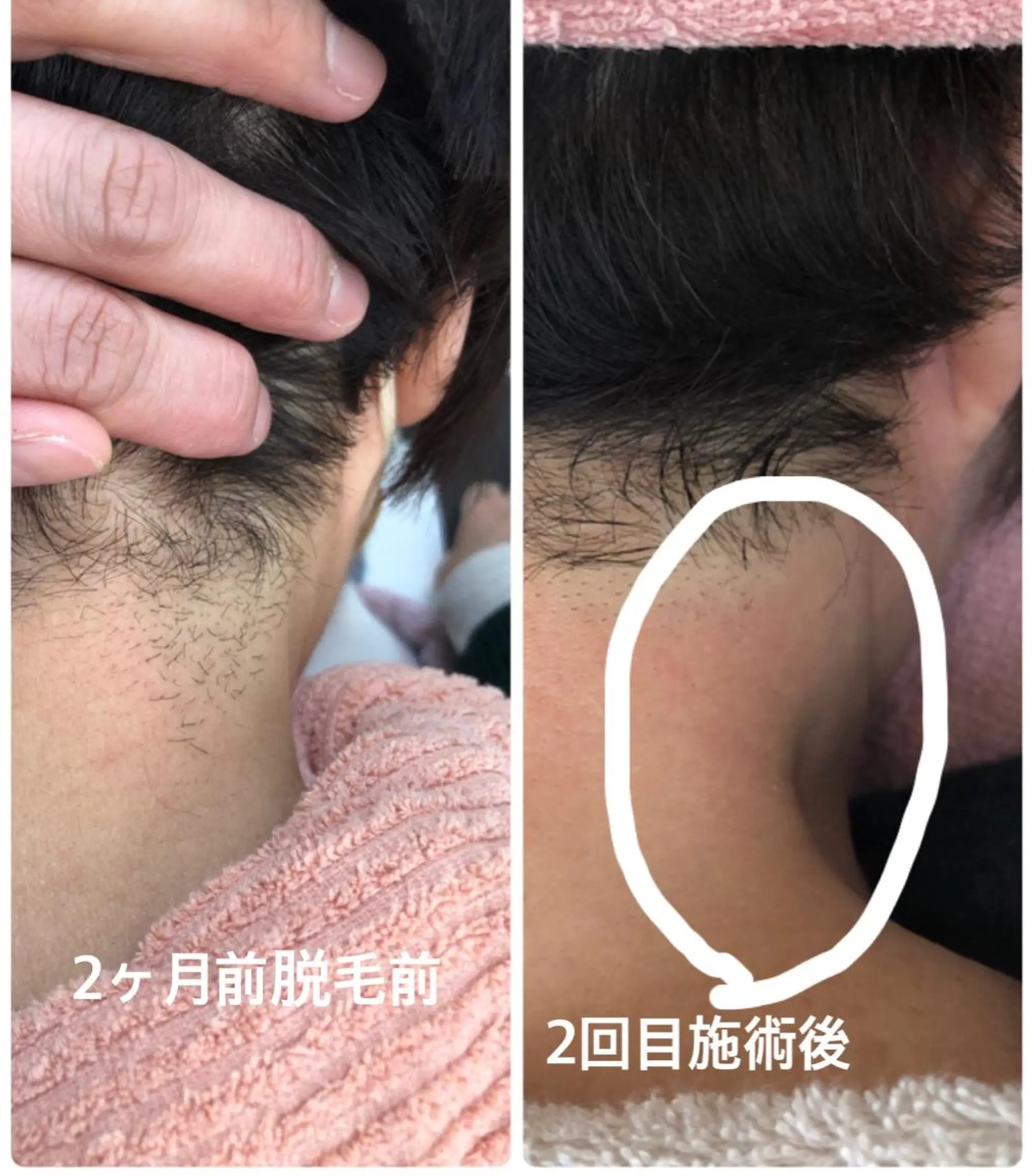 小顔と腸の専門店 ラクーラビューティのエステ・リラクイメージ