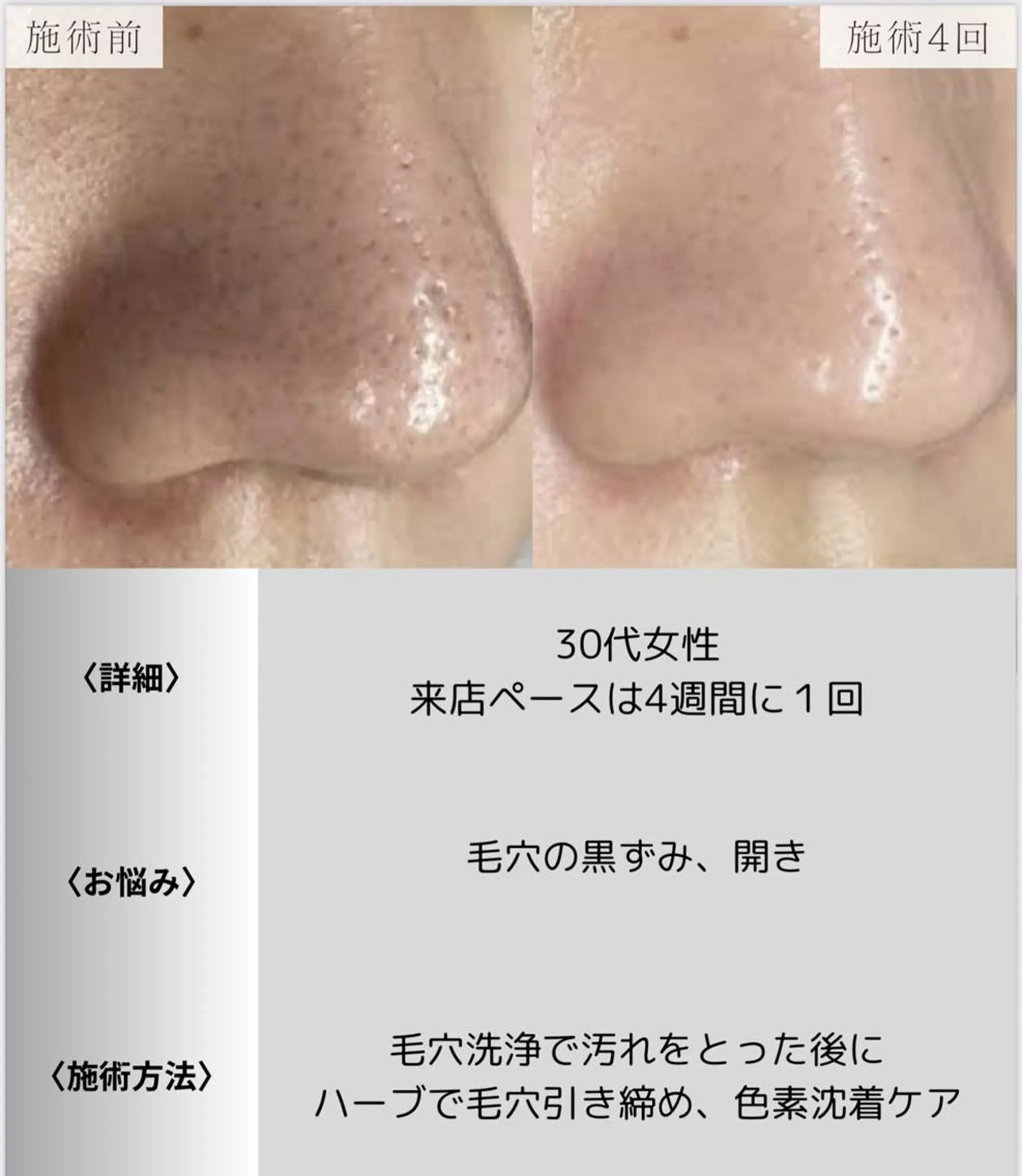 脱毛・眉毛・フェイス サロンN久留米店のその他イメージ