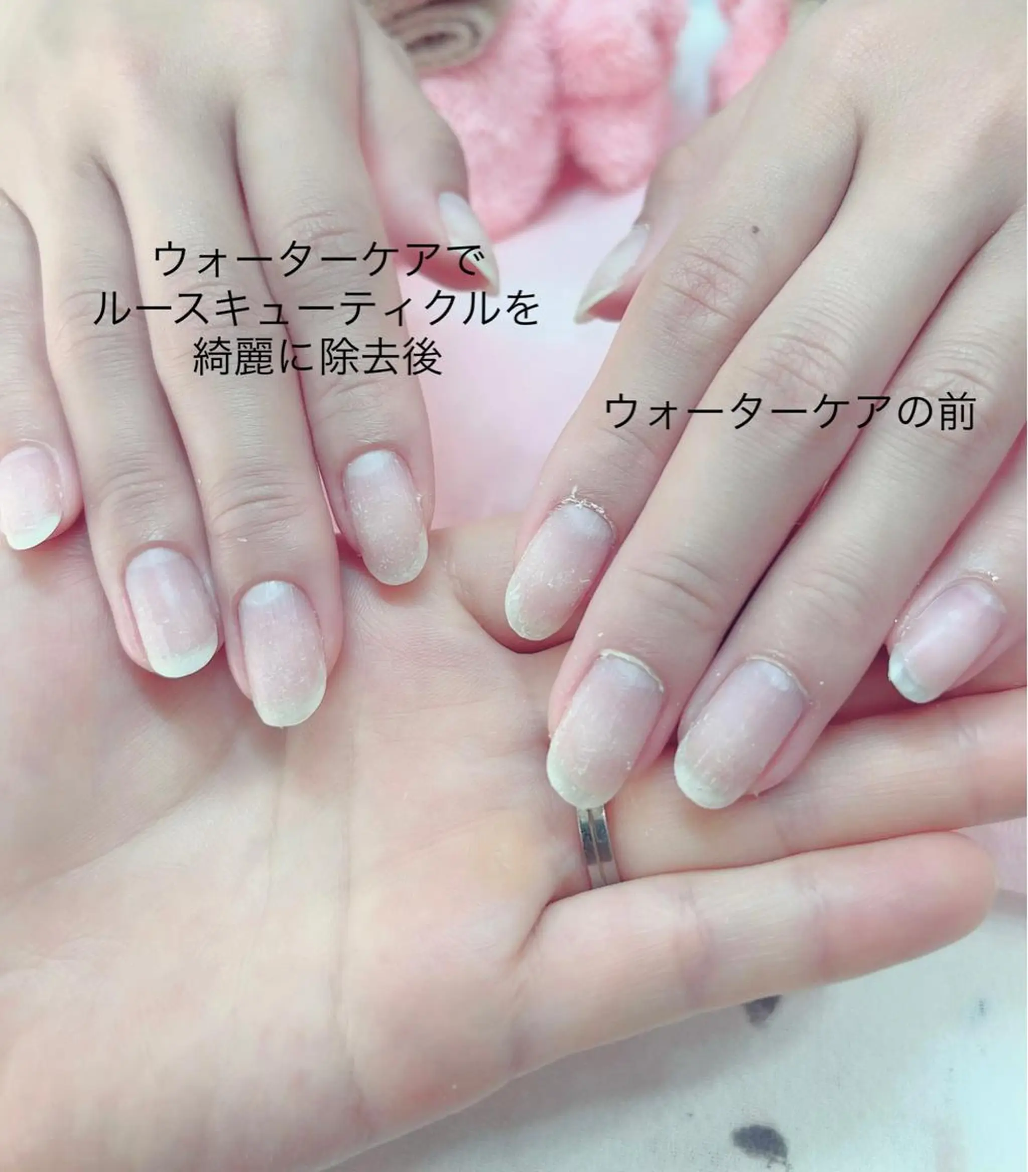 ネイル 北浦和 自爪育成ケアのネイルデザイン