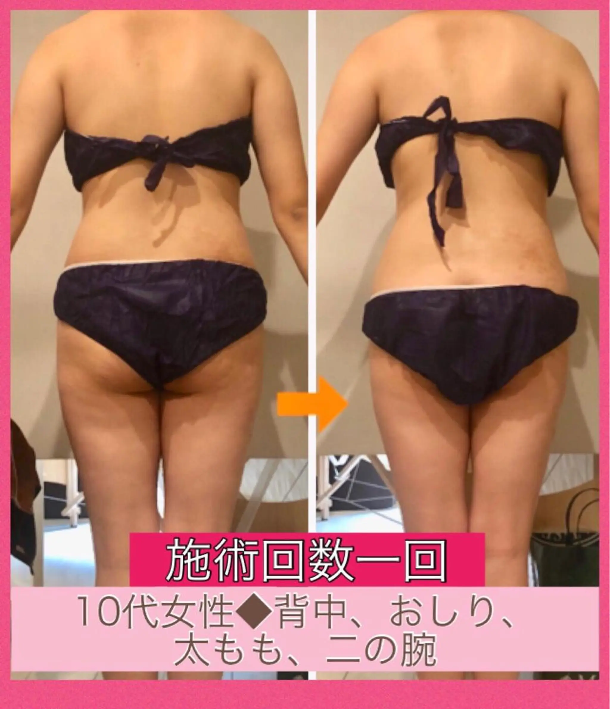 ロング カラー パーマ ヘアアレンジ メンズ キッズ ネイル マツエク・マツパ ‍痩身＆ボディ 結果出し🌟丹野のエステ・リラクイメージ