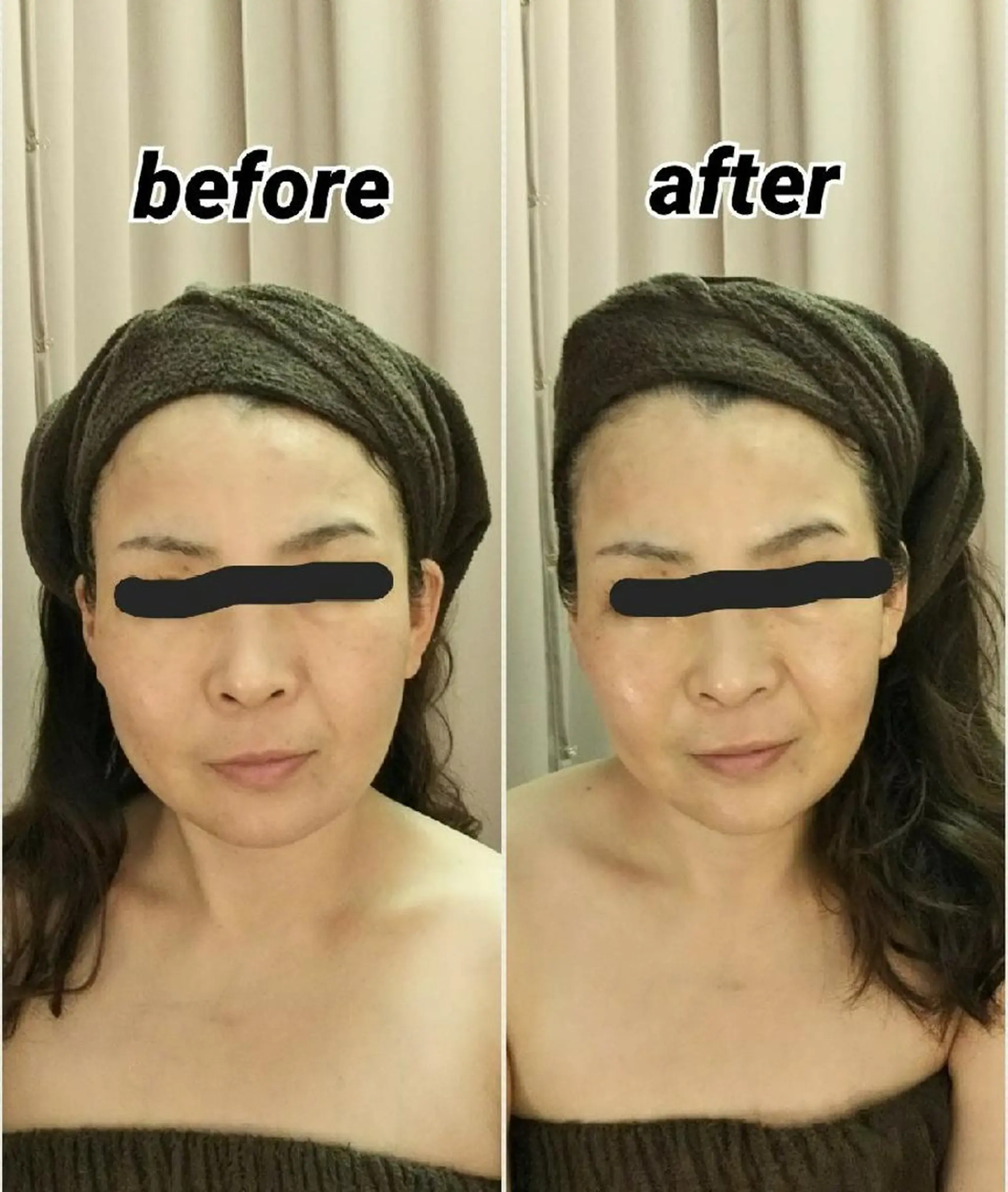 小顔と美肌 まごころエステMatoria所属・小顔 美肌専門 Matoriaのエステ・リラクイメージ