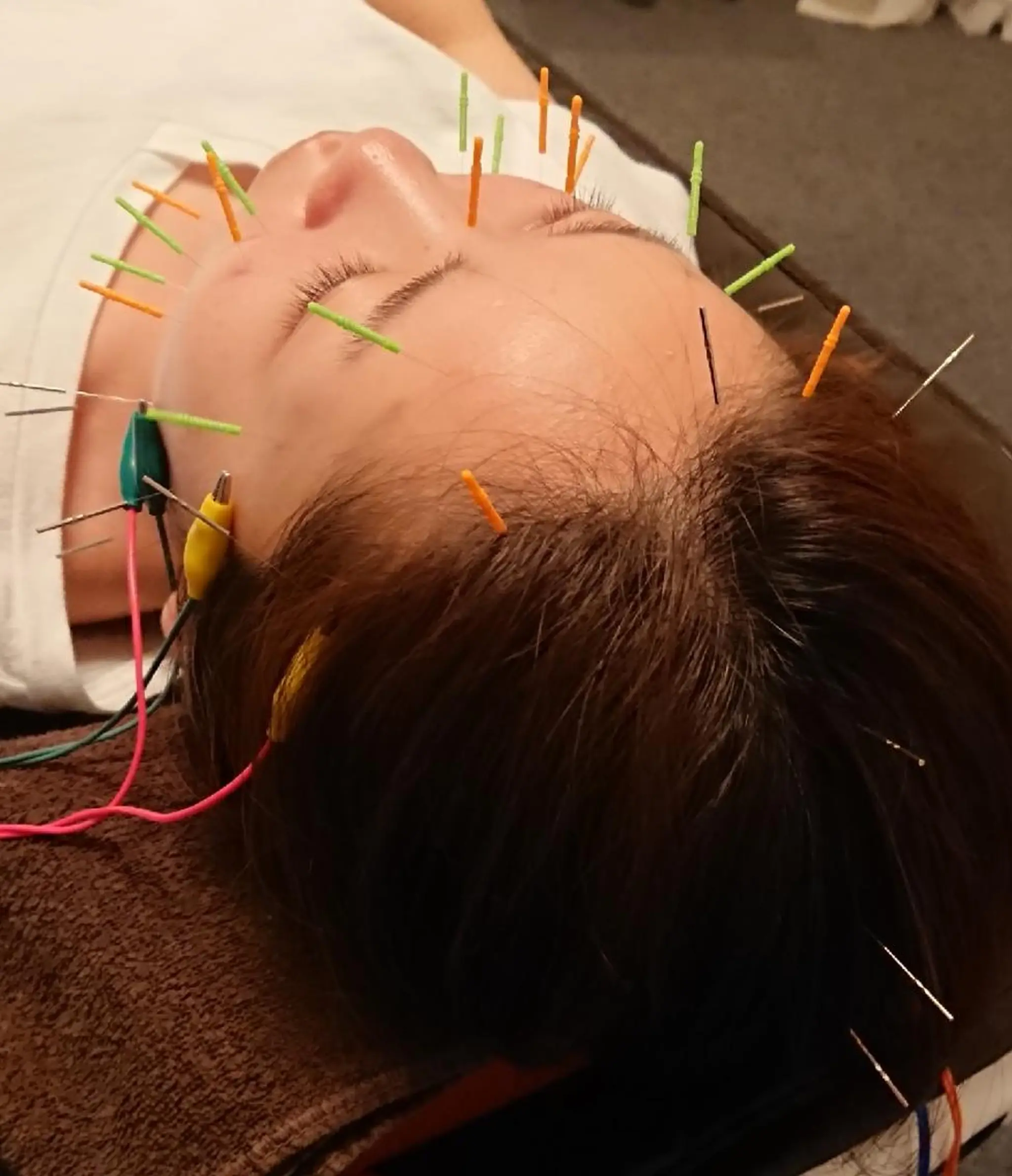 鍼灸サロンKEYAKI所属・美容鍼灸師 皆吉 秀樹のエステ・リラクイメージ