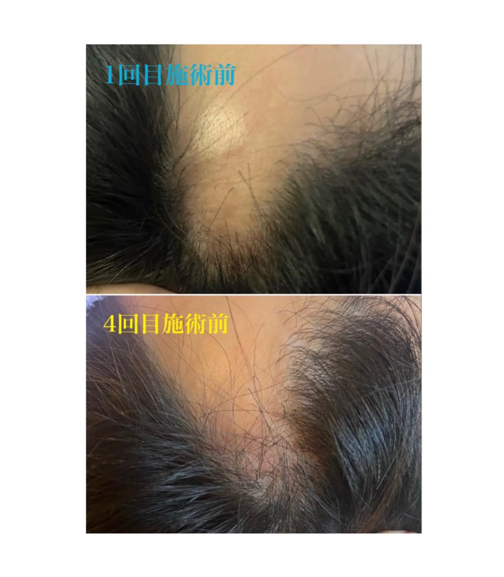 アロマ･美容鍼･カッ ピング「麗」鍼灸院のエステ・リラクイメージ