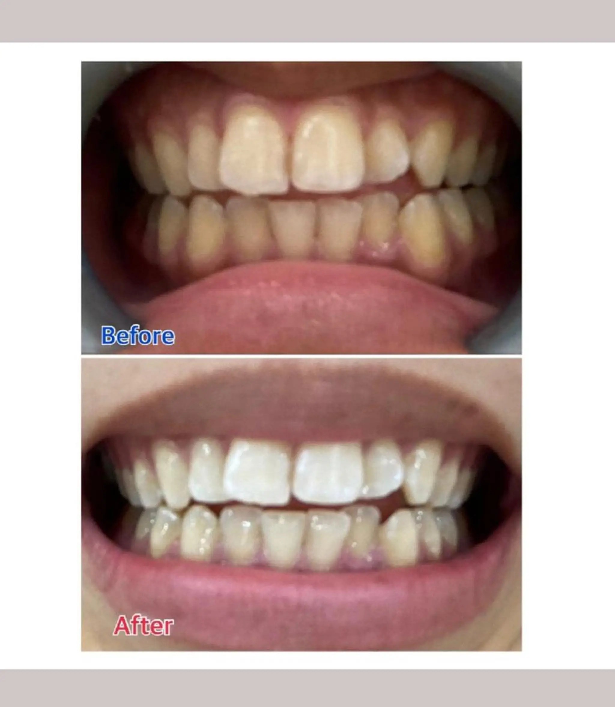 M渋谷店所属・M渋谷 ホワイトニングのエステ・リラクイメージ