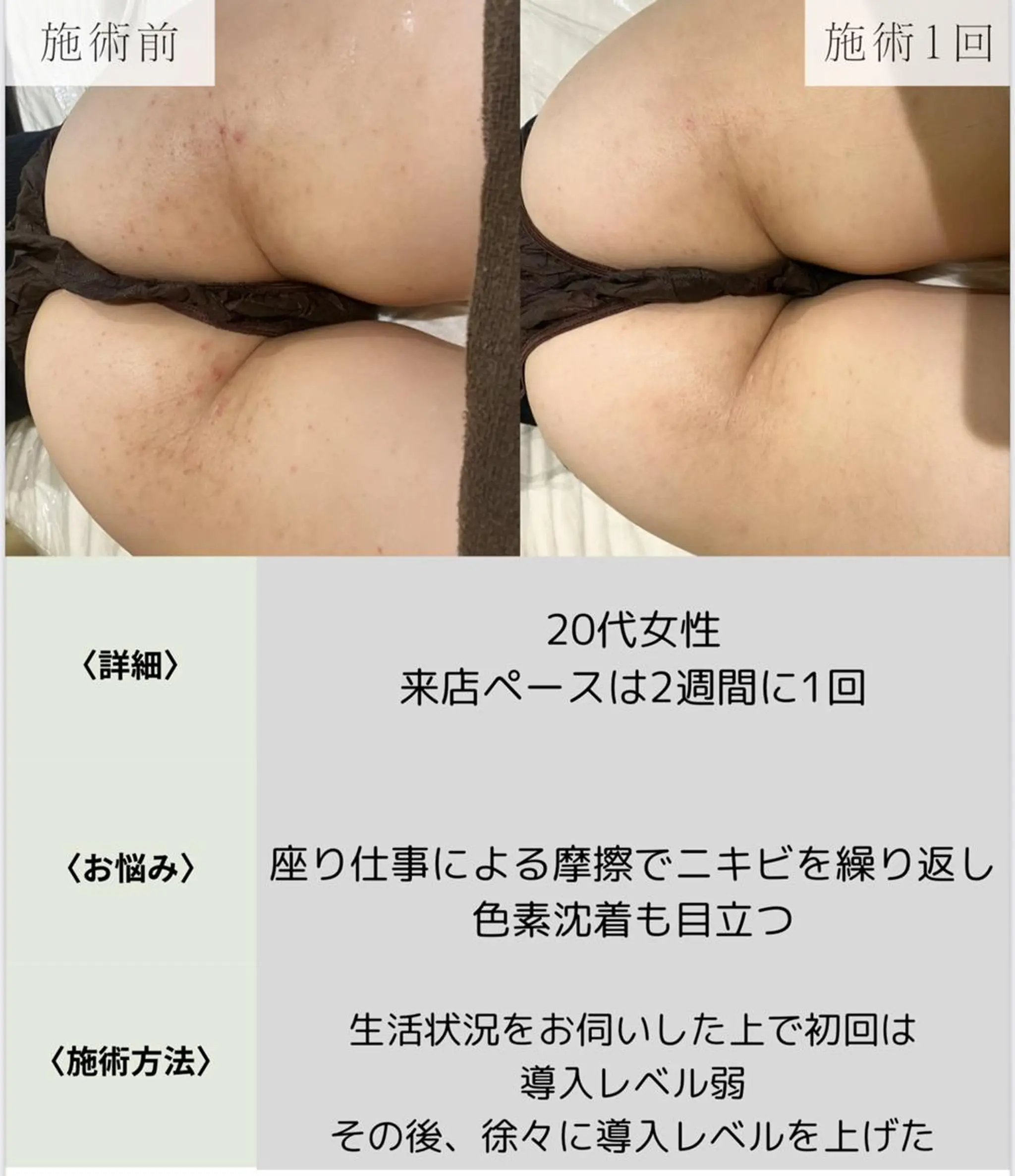 脱毛・眉毛・フェイス サロンN久留米店のその他イメージ