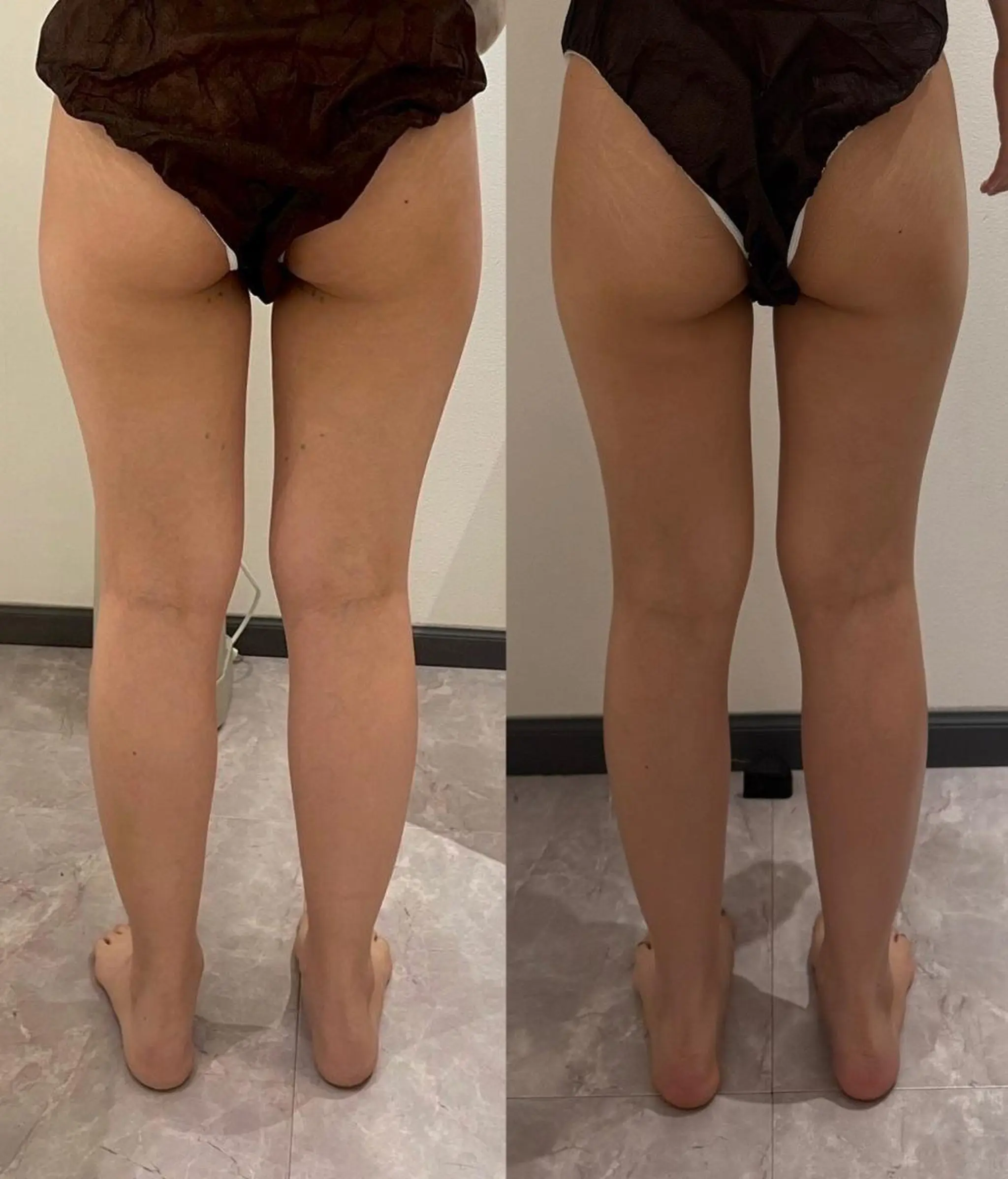 その他 NACHUL MANAのエステ・リラクイメージ