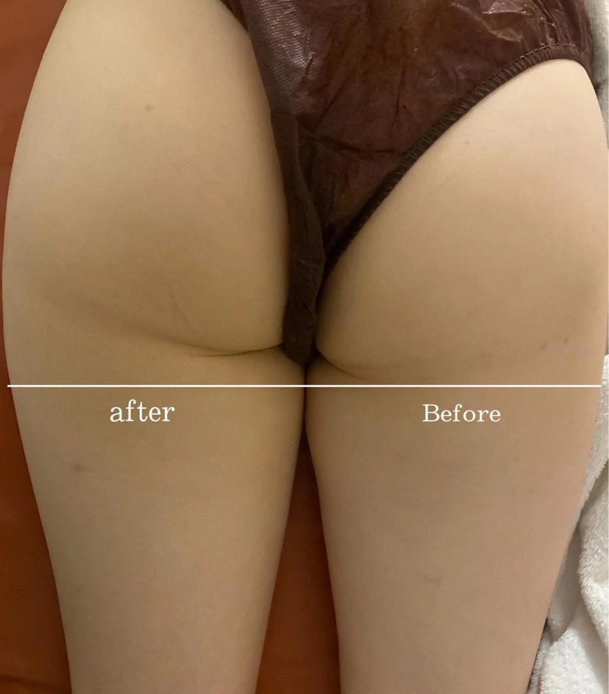 整♡深層リンパ ronronのその他イメージ