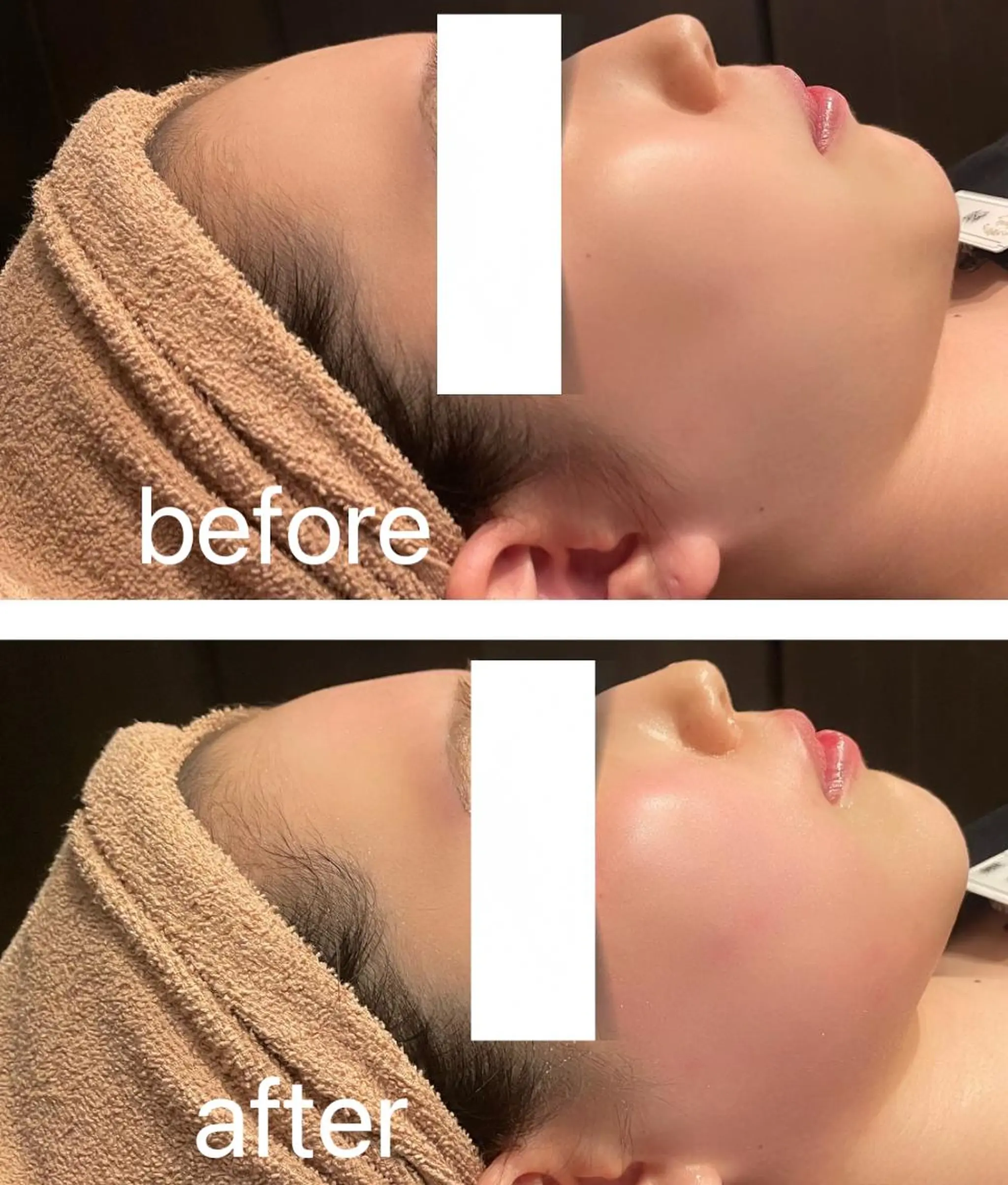 👑Linolaby RAYVIS👑🌼のエステ・リラクイメージ