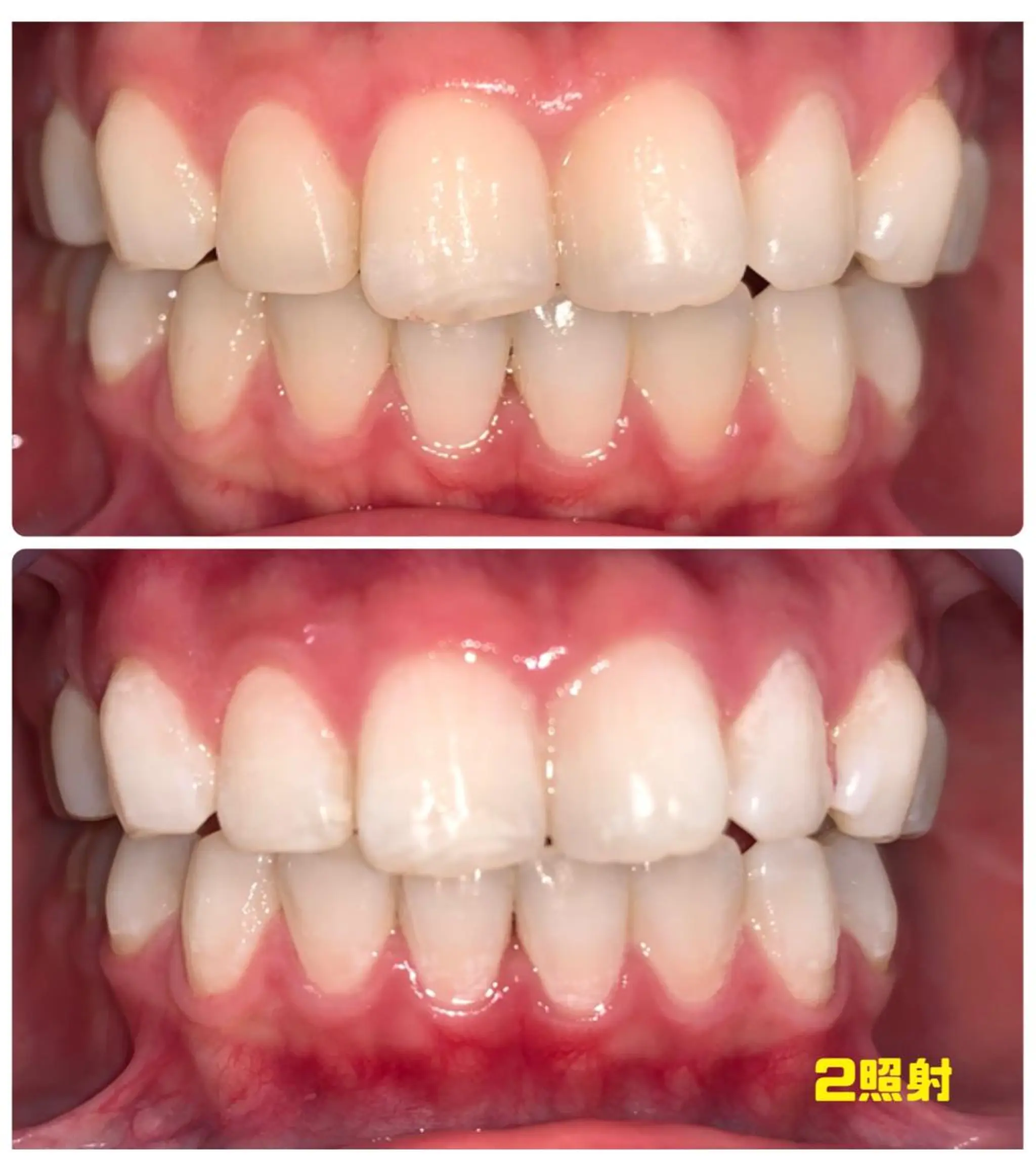 LOVE ホワイトニング渋谷のその他イメージ