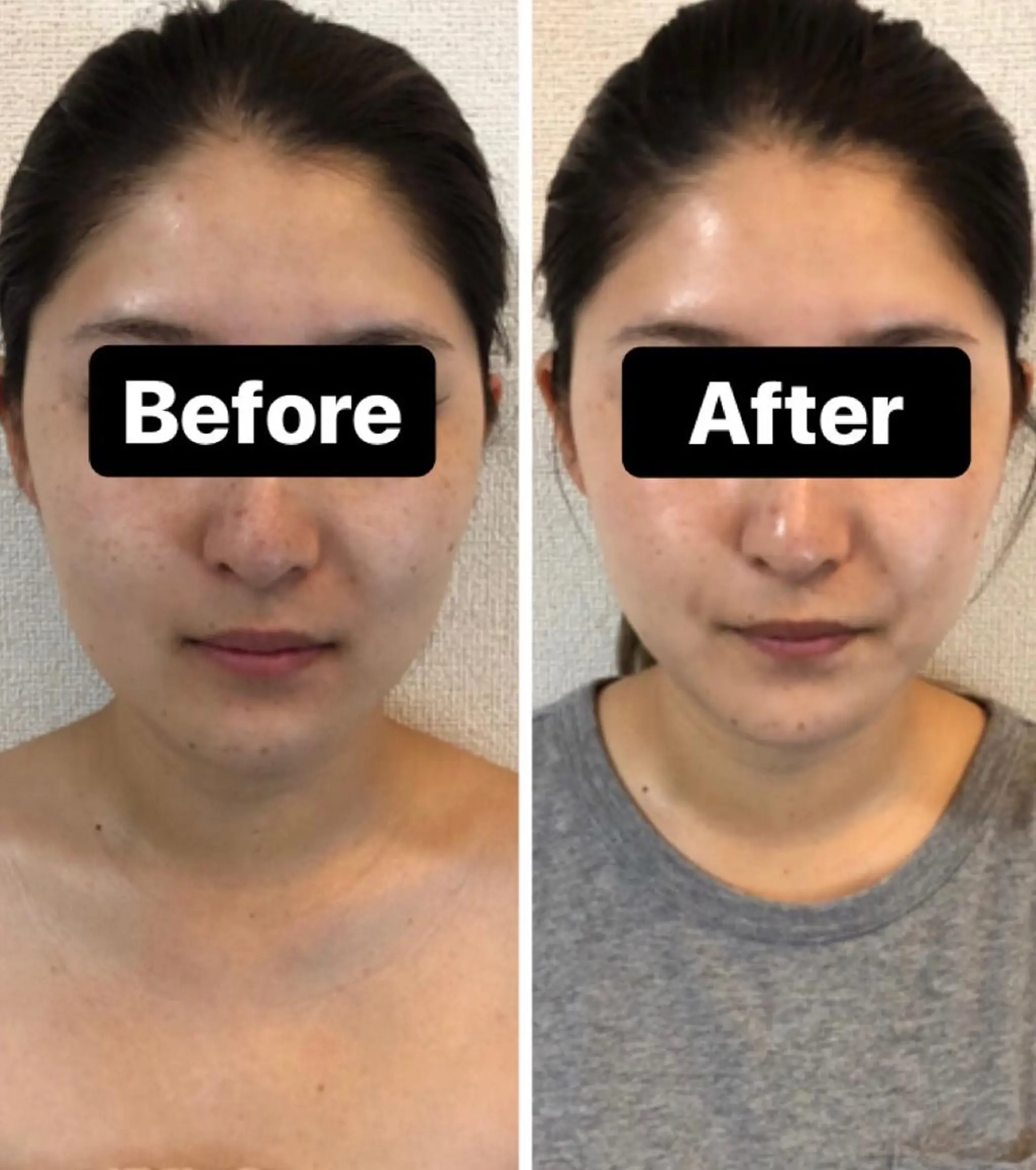 エステ 石川 詩織のエステ・リラクイメージ