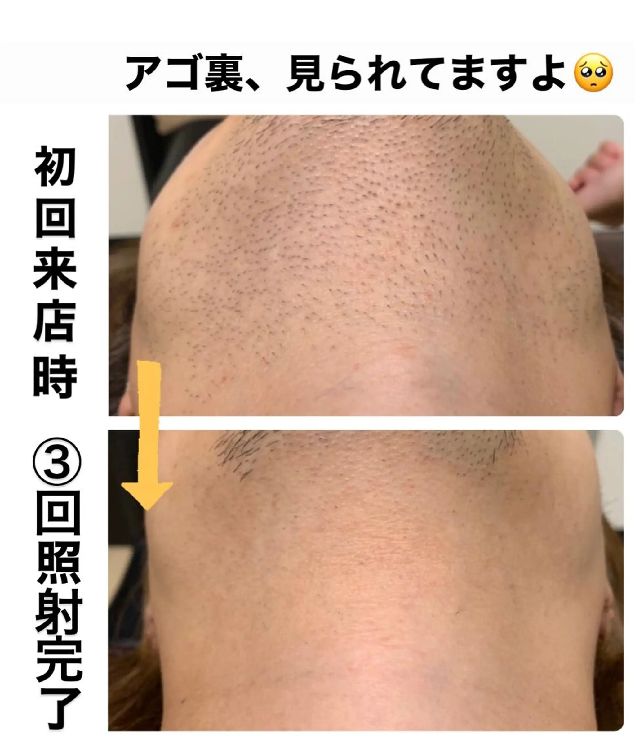 メンズ メンズ脱毛サロン Le falcoのエステ・リラクイメージ