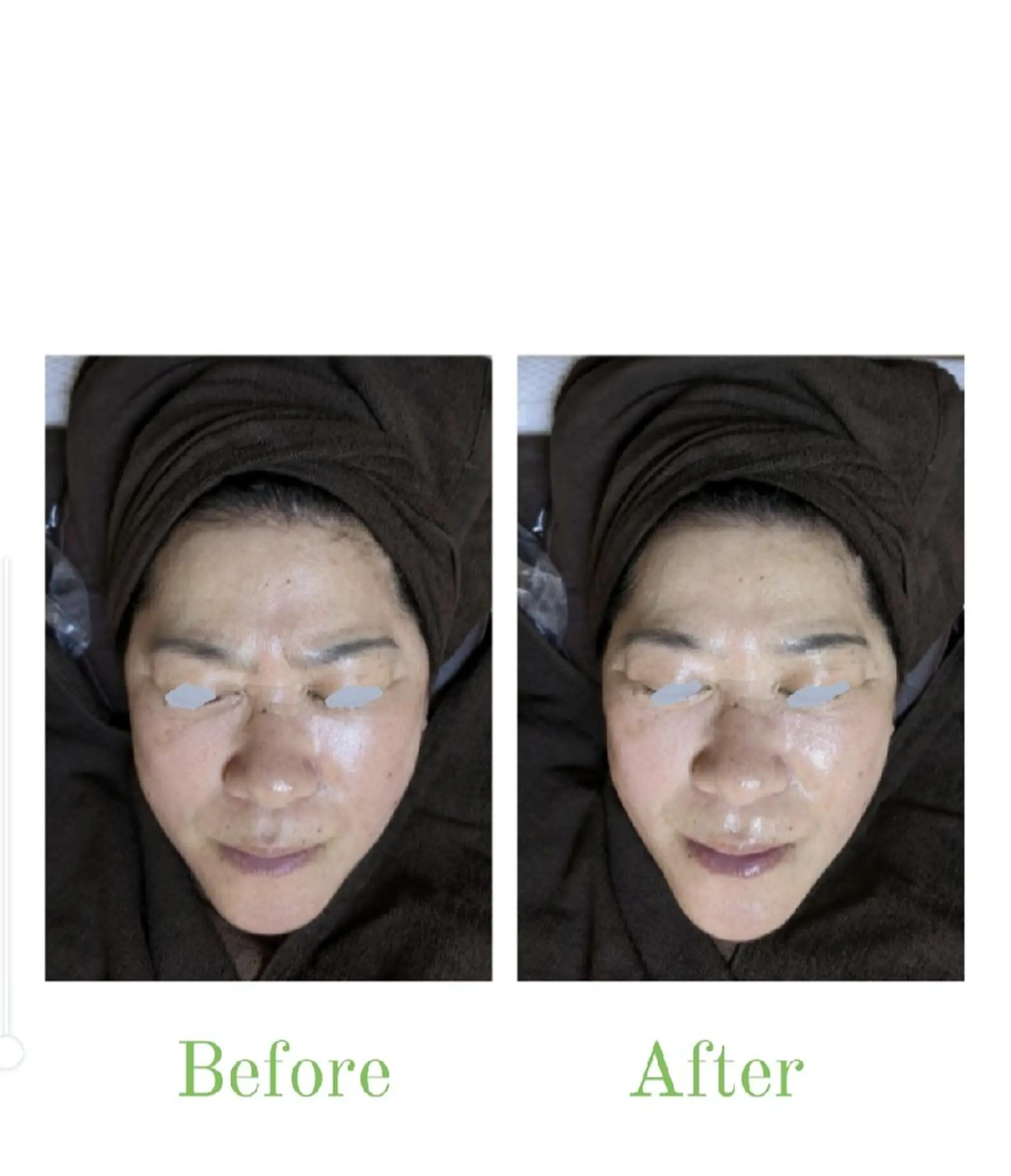 エステ TotalBeauty axis所属・本気の痩身🕊渡邊 明子🕊のその他イメージ